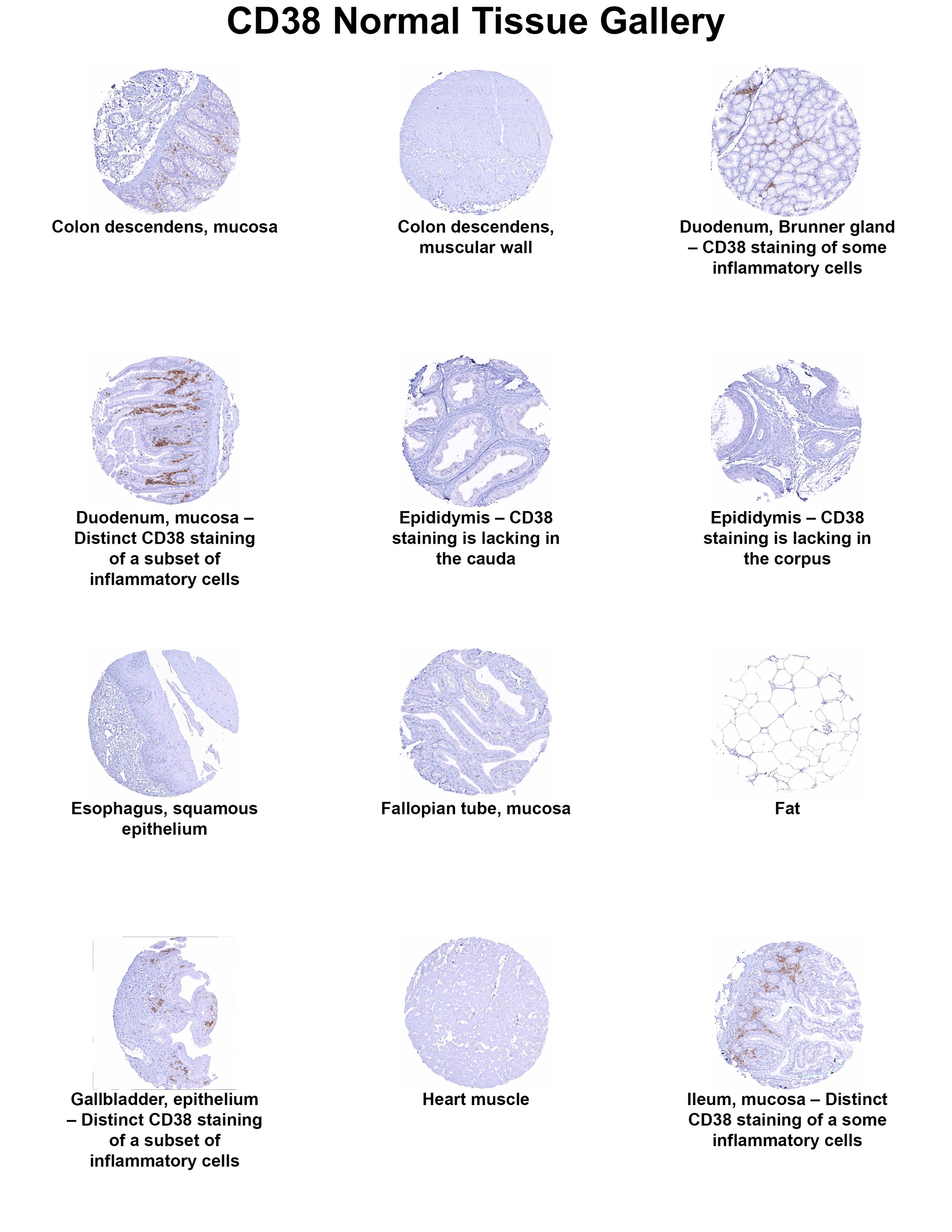 CD38 Antibody (MSVA-038R) CD38 Antibody (MSVA-038R) CD38 Normal Tissue Gallery