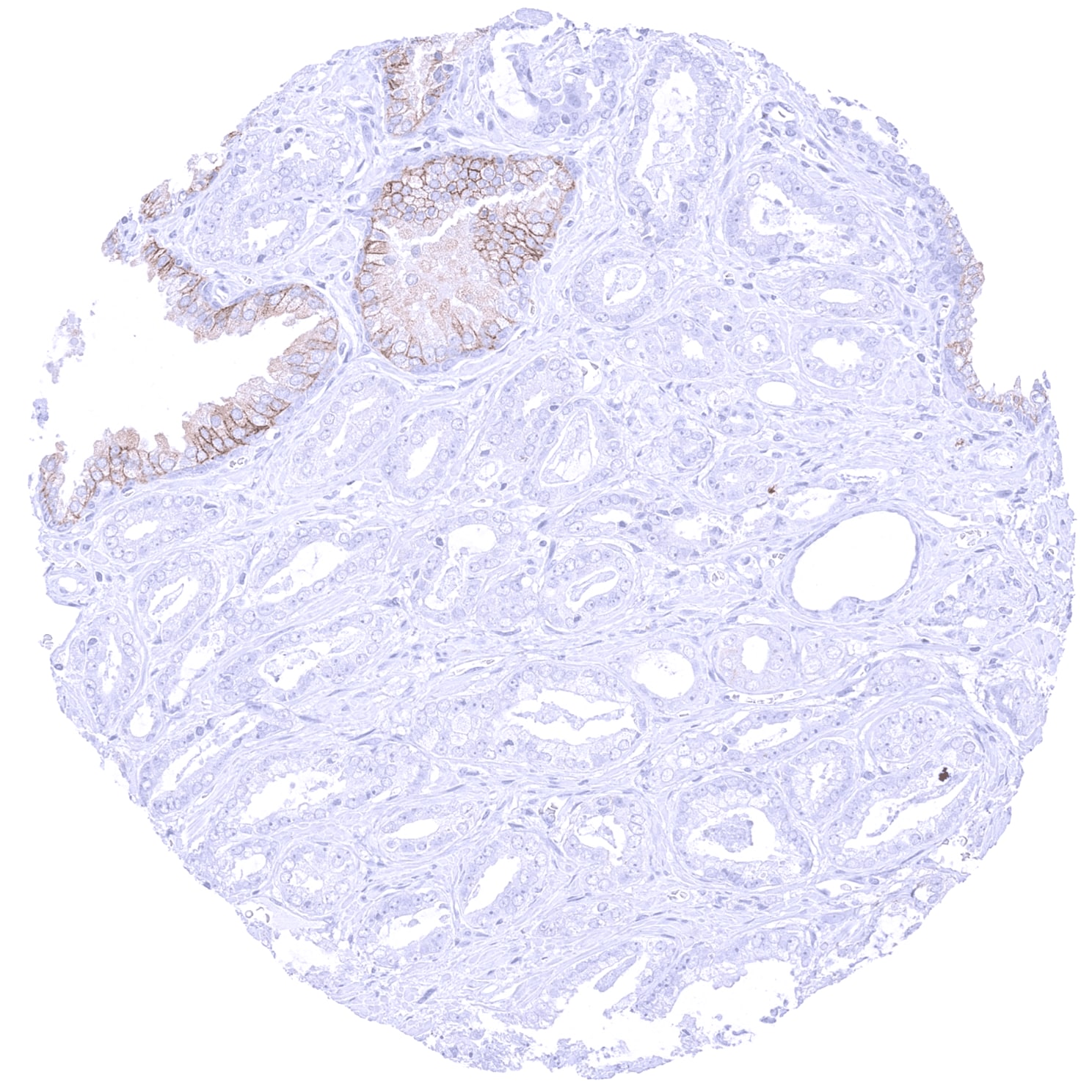 CD38 Antibody (MSVA-038R)
