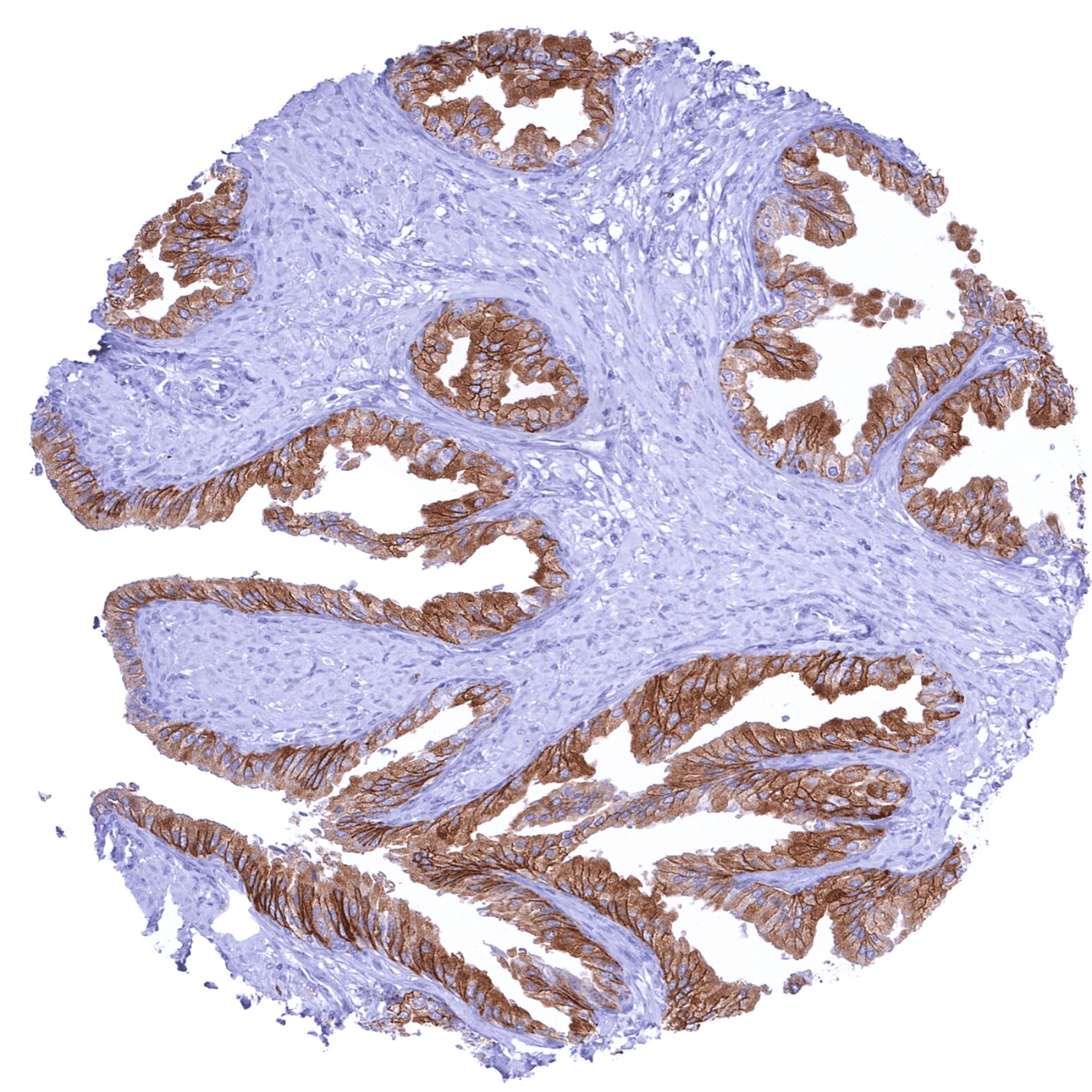 CD38 Antibody (MSVA-038R)