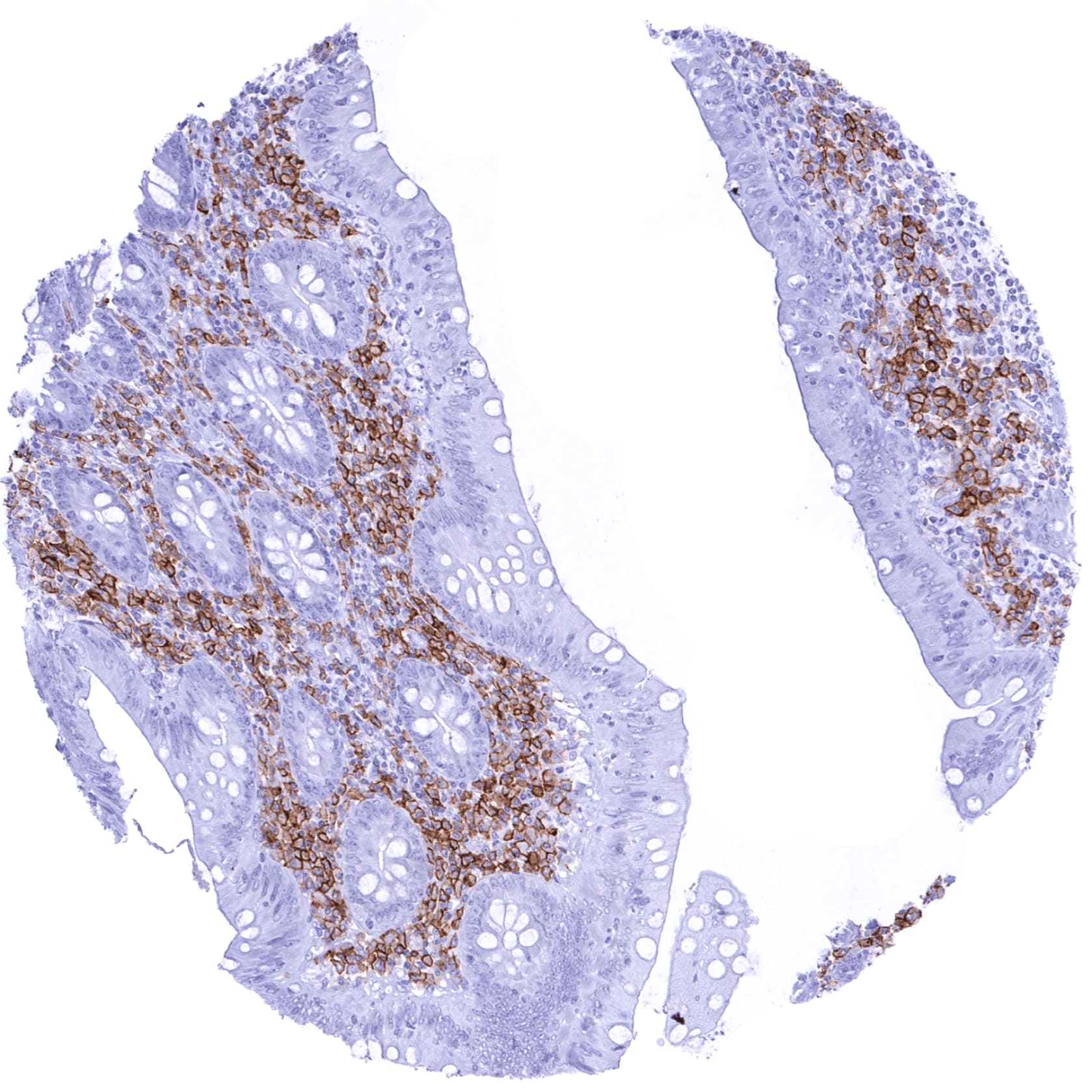 CD38 Antibody (MSVA-038R)