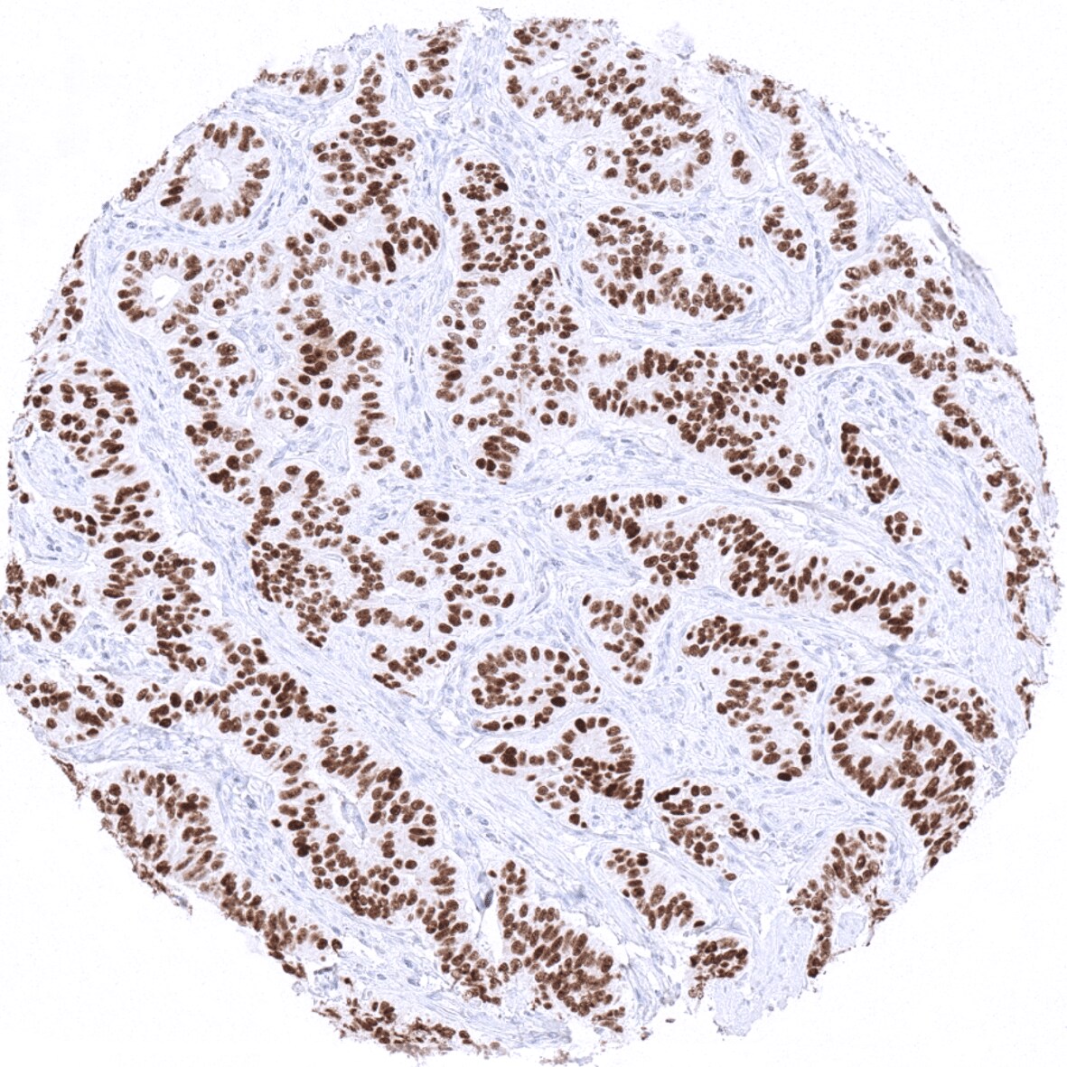 INSM1 Antibody (MSVA-456R)