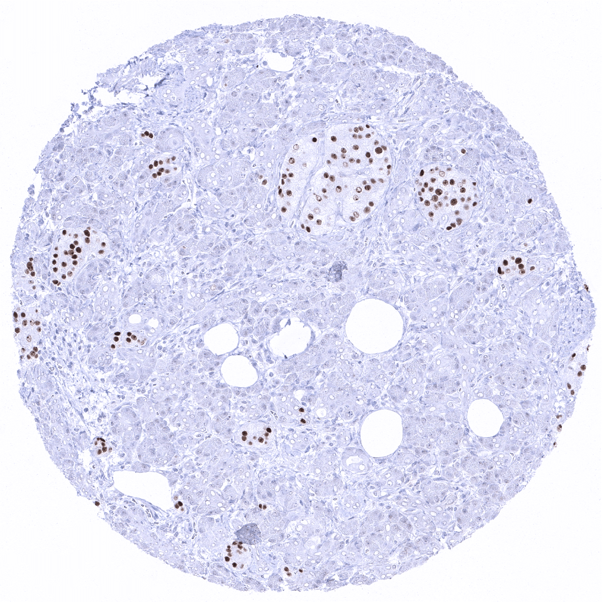 INSM1 Antibody (MSVA-456R)