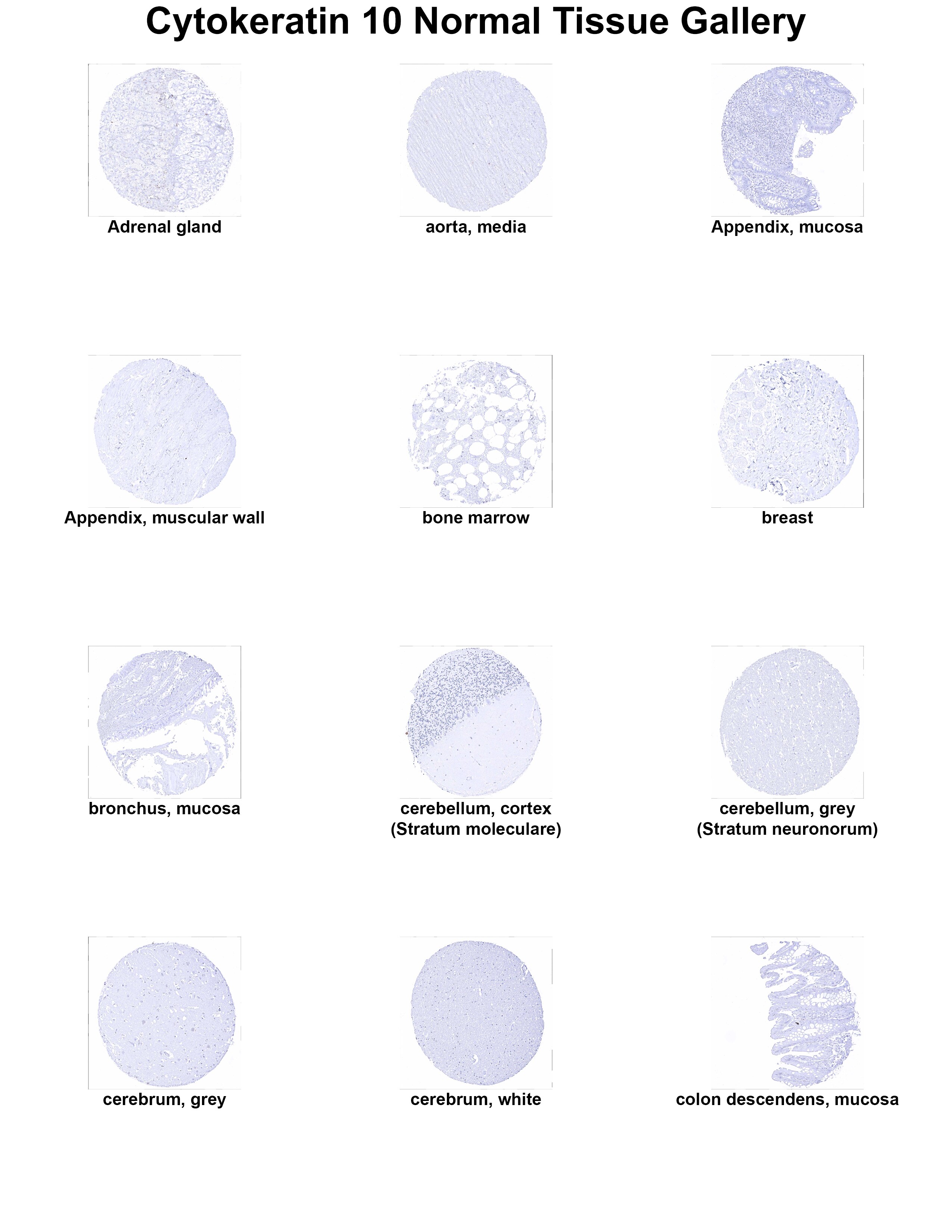 Cytokeratin 10 Antibody (MSVA-610M) Cytokeratin 10 Antibody (MSVA-610M) Cytokeratin 10 Normal Tissue Gallery