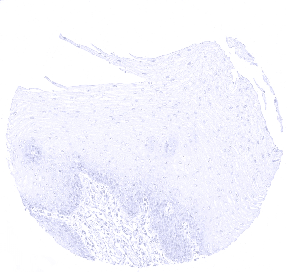 Cytokeratin 10 Antibody (MSVA-610M)