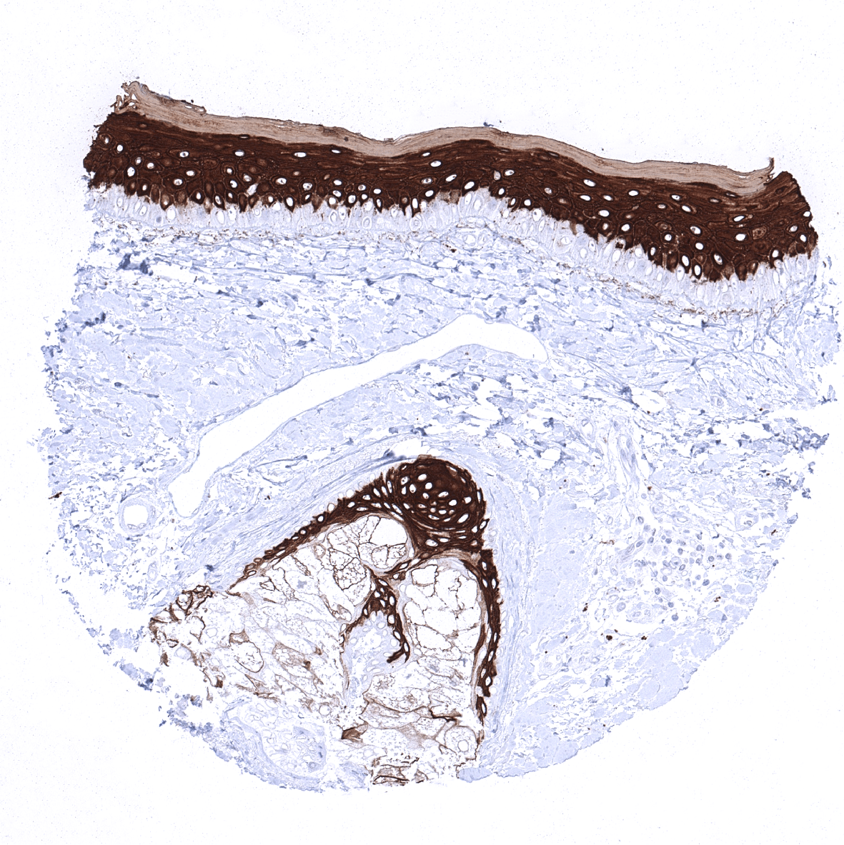 Cytokeratin 10 Antibody (MSVA-610M)