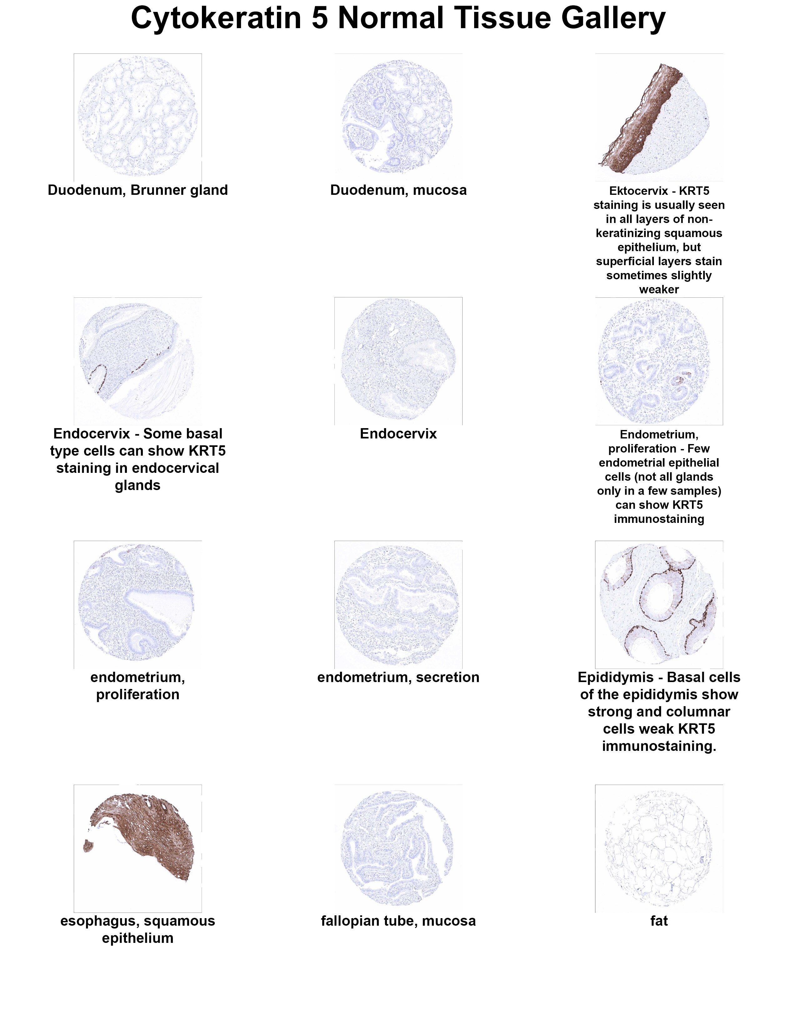 Cytokeratin 5 Antibody (MSVA-605M) Cytokeratin 5 Antibody (MSVA-605M) Cytokeratin 5 Normal Tissue Gallery