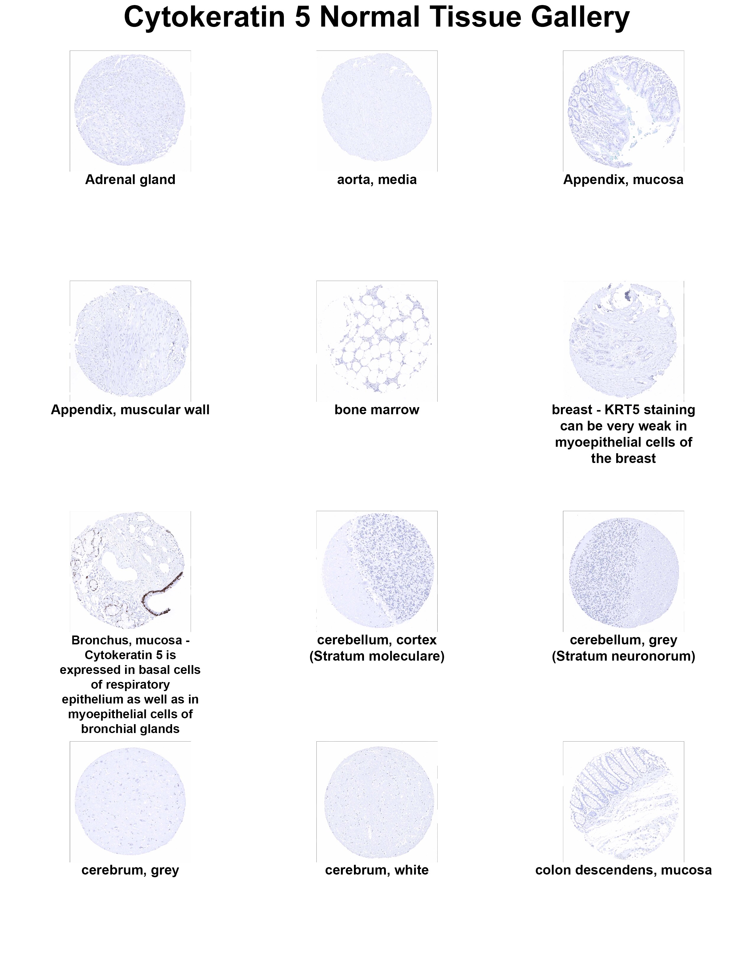 Cytokeratin 5 Antibody (MSVA-605M) Cytokeratin 5 Antibody (MSVA-605M) Cytokeratin 5 Normal Tissue Gallery