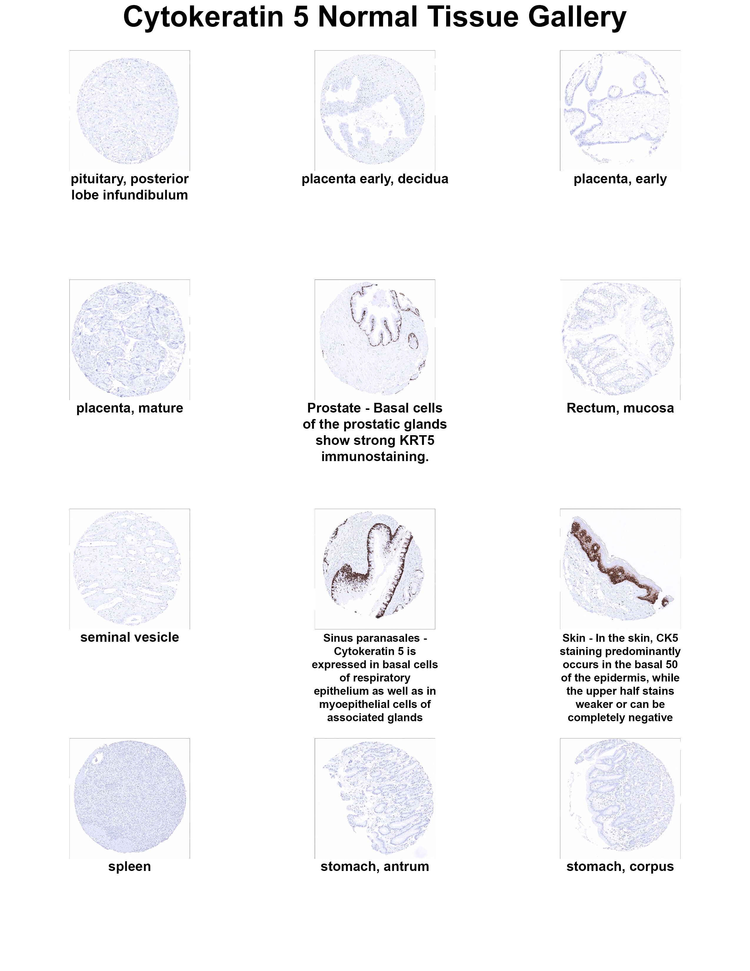 Cytokeratin 5 Antibody (MSVA-605M) Cytokeratin 5 Antibody (MSVA-605M) Cytokeratin 5 Normal Tissue Gallery