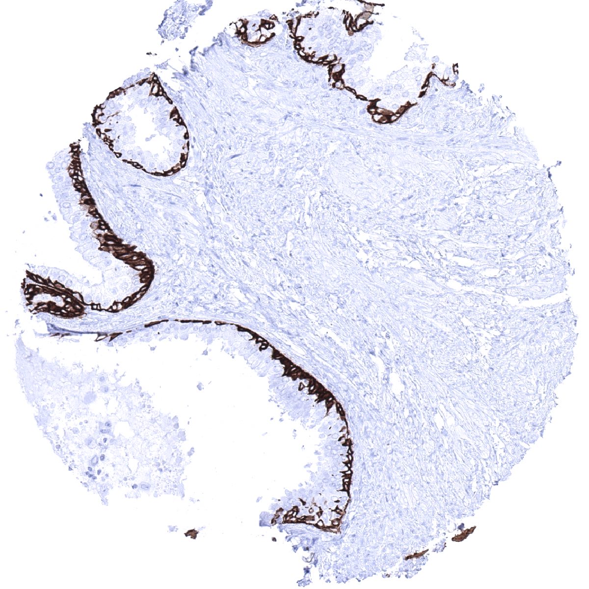 Cytokeratin 5 Antibody (MSVA-605M)