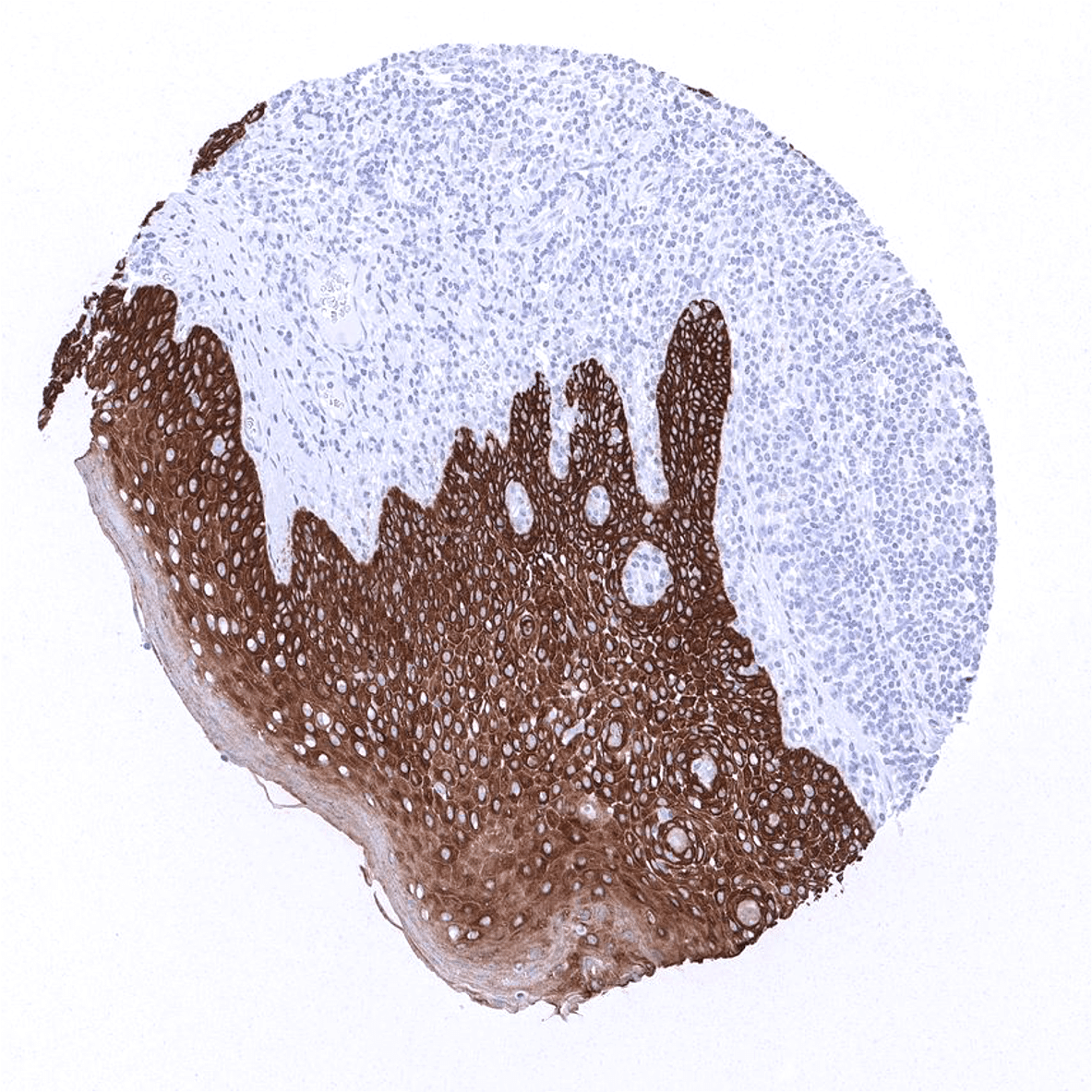 Cytokeratin 5 Antibody (MSVA-605M)