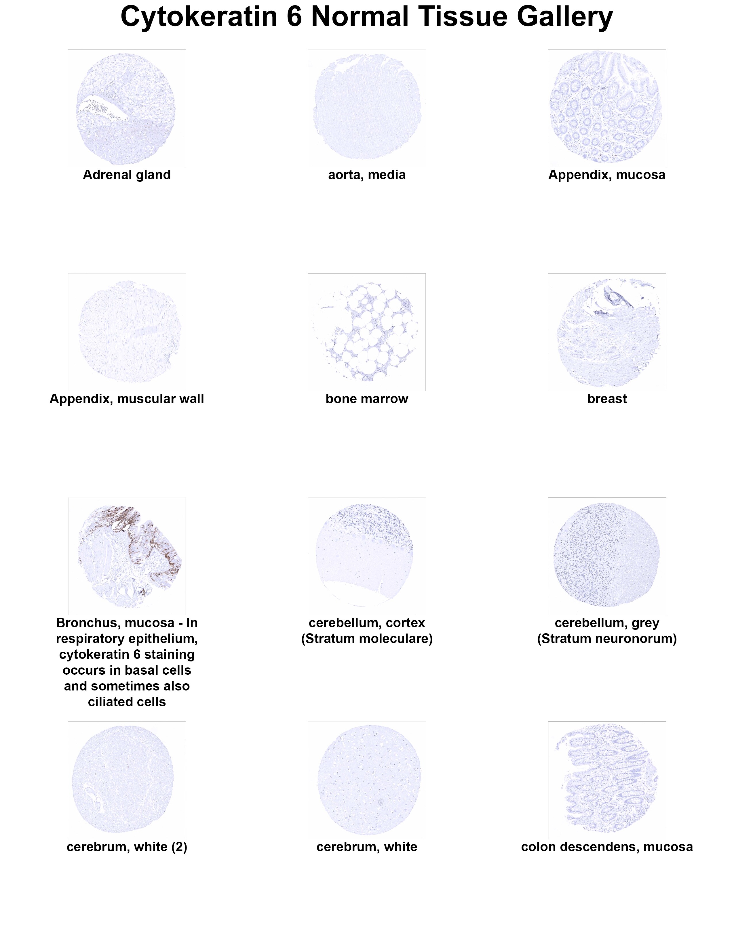 Cytokeratin 6 Antibody (MSVA-606R) Cytokeratin 6 Antibody (MSVA-606R) Cytokeratin 6 Normal Tissue Gallery