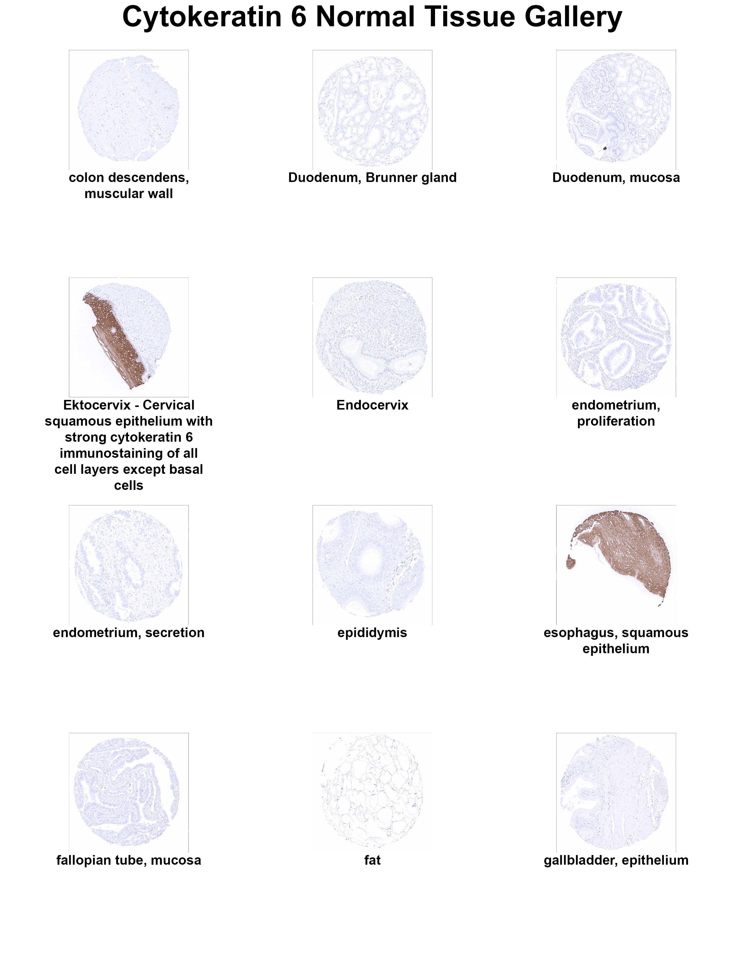 Cytokeratin 6 Antibody (MSVA-606R) Cytokeratin 6 Antibody (MSVA-606R) Cytokeratin 6 Normal Tissue Gallery