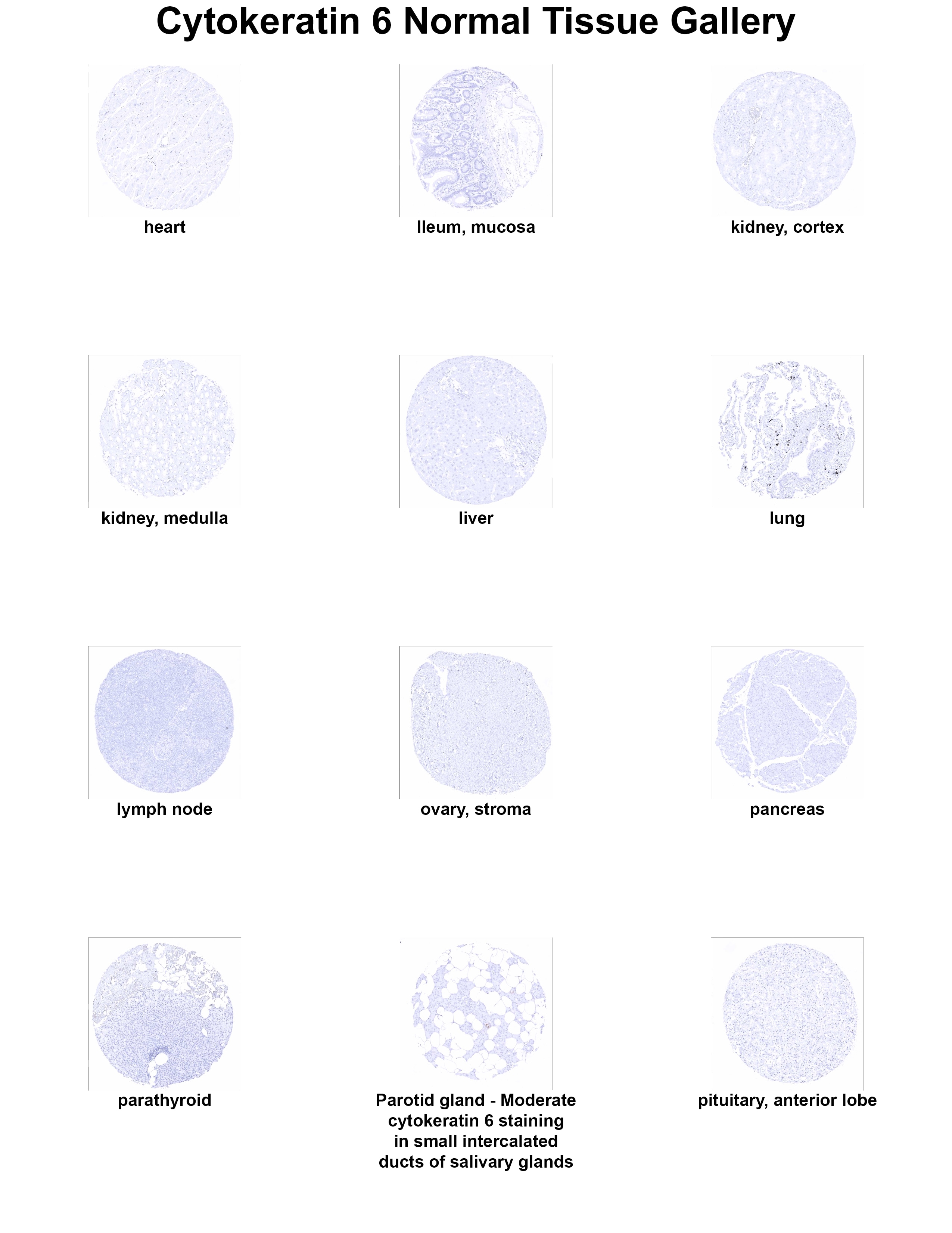 Cytokeratin 6 Antibody (MSVA-606R) Cytokeratin 6 Antibody (MSVA-606R) Cytokeratin 6 Normal Tissue Gallery
