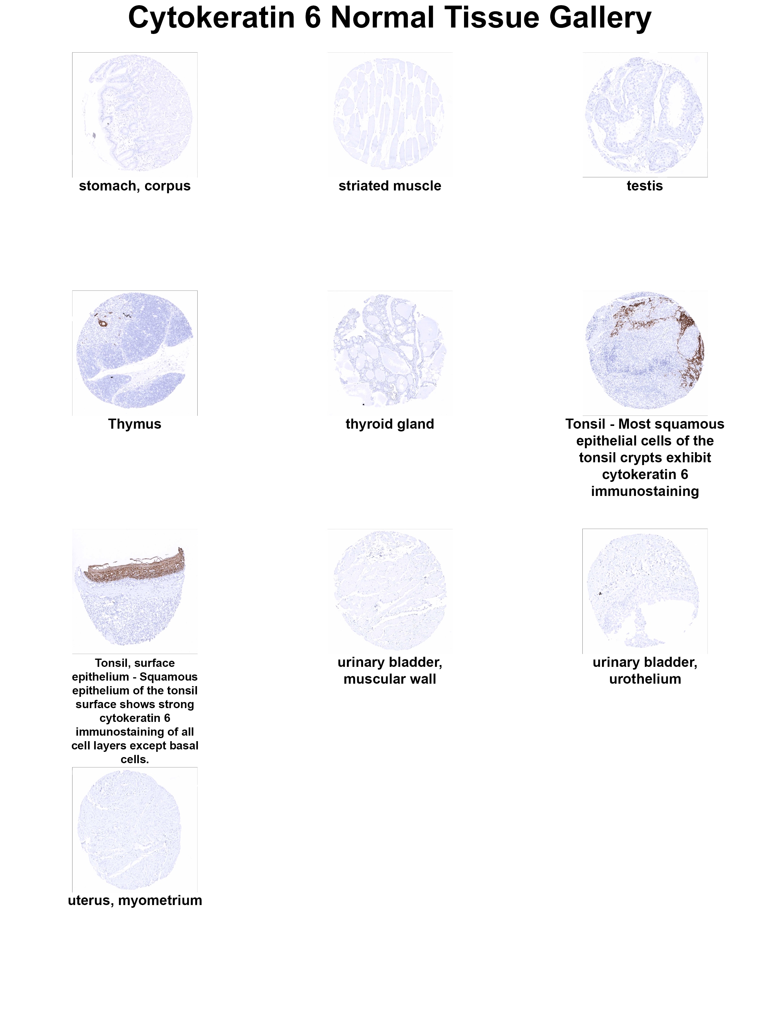 Cytokeratin 6 Antibody (MSVA-606R) Cytokeratin 6 Antibody (MSVA-606R) Cytokeratin 6 Normal Tissue Gallery