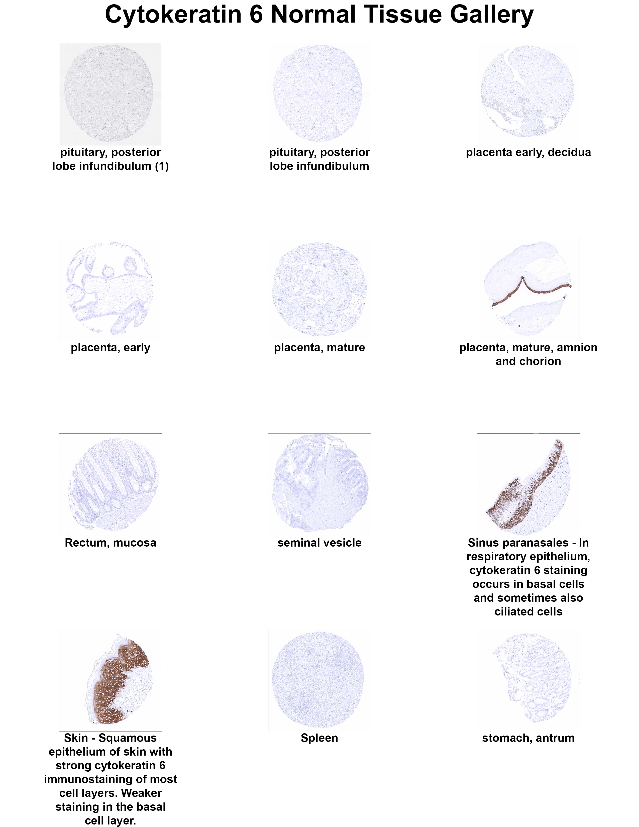 Cytokeratin 6 Antibody (MSVA-606R) Cytokeratin 6 Antibody (MSVA-606R) Cytokeratin 6 Normal Tissue Gallery