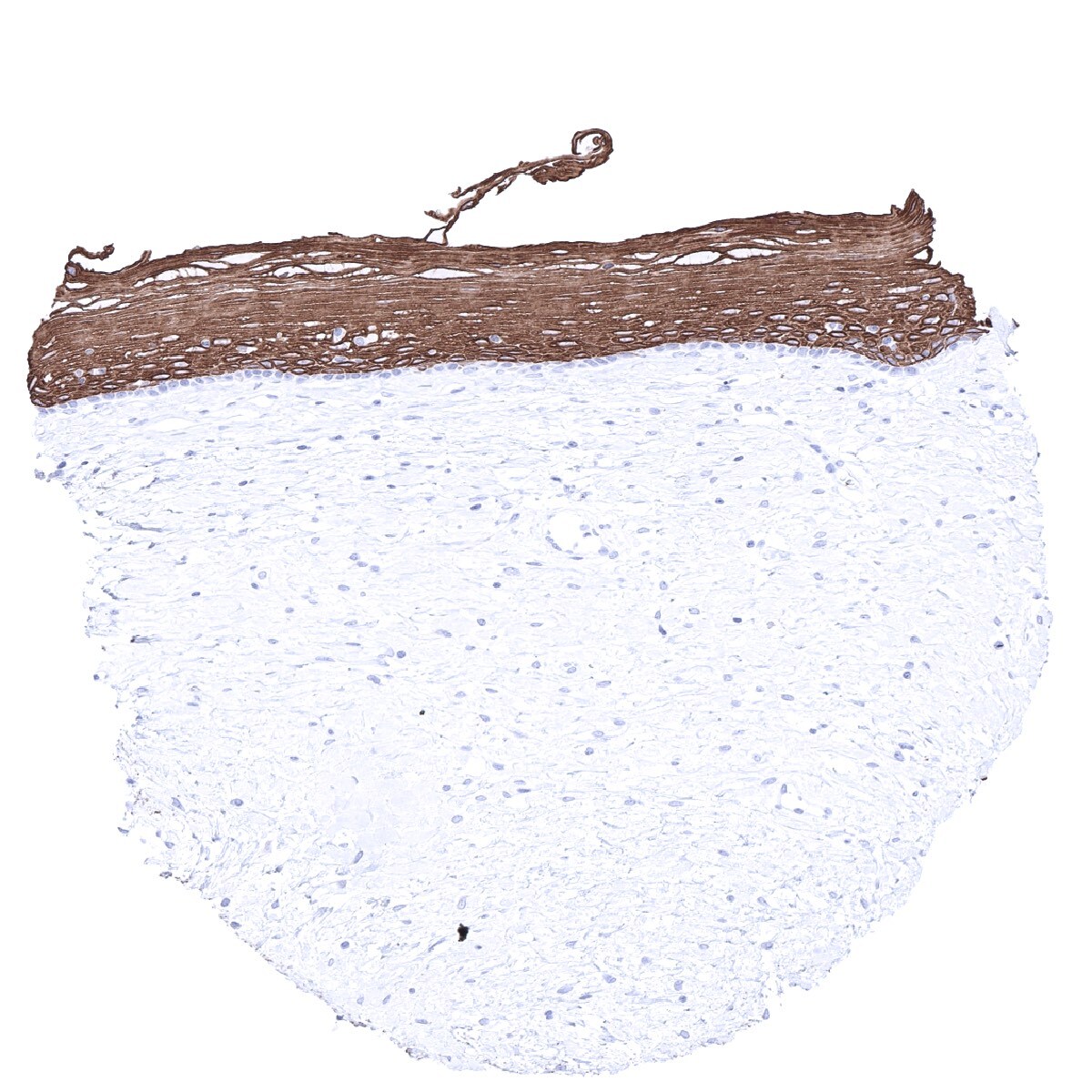 Cytokeratin 6 Antibody (MSVA-606R)