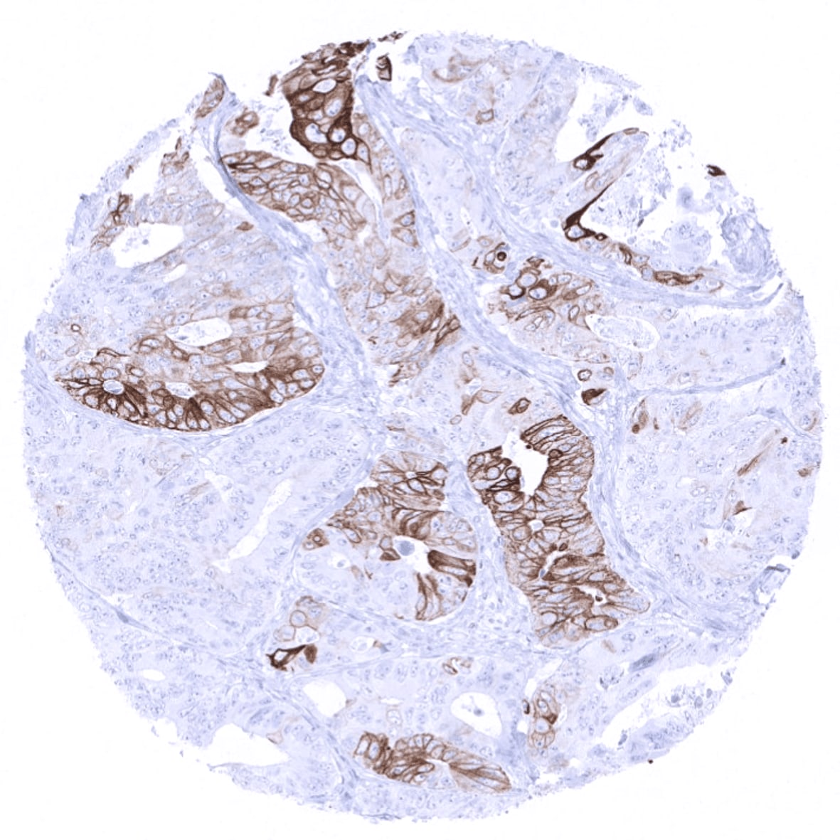 Cytokeratin 6 Antibody (MSVA-606R)