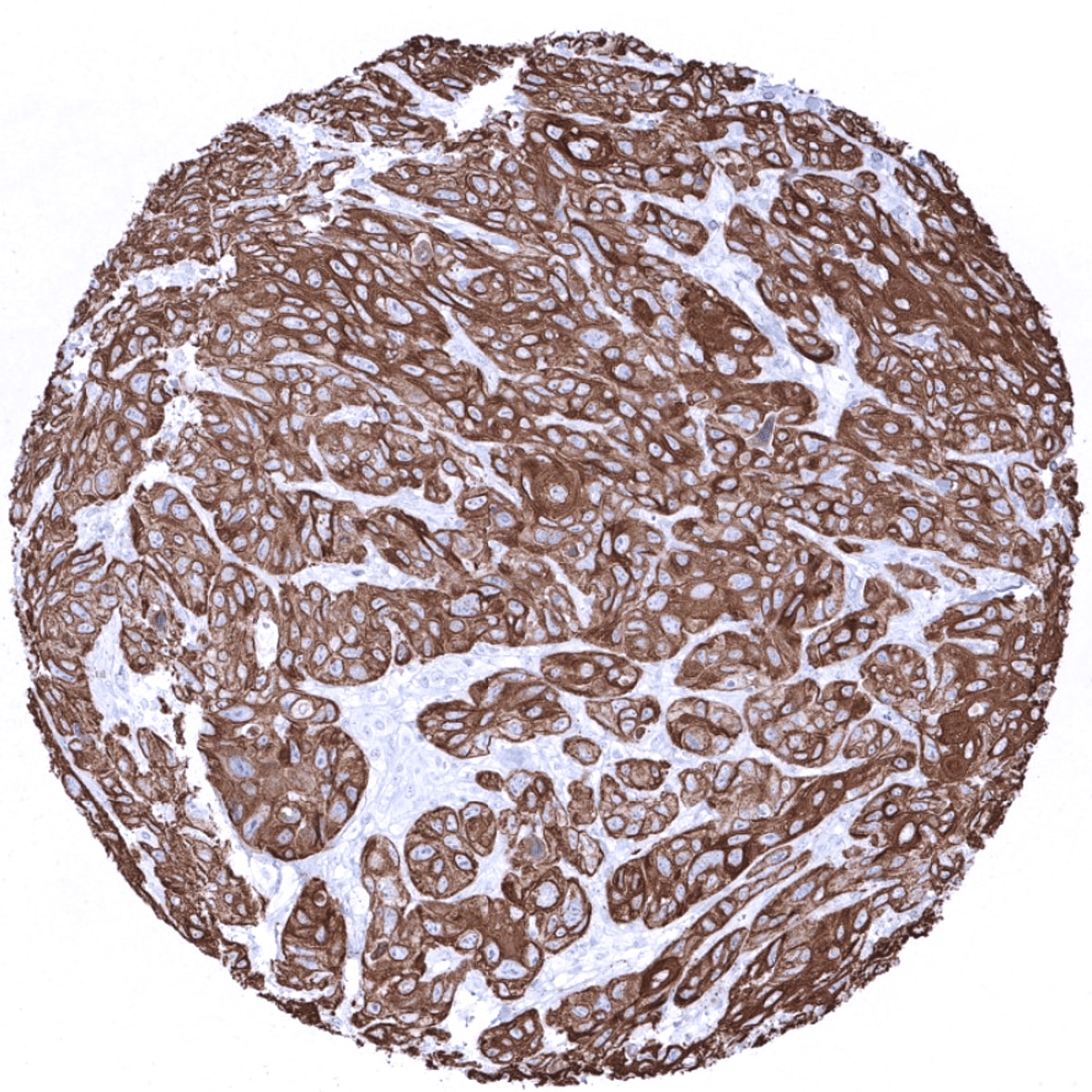 Cytokeratin 6 Antibody (MSVA-606R)
