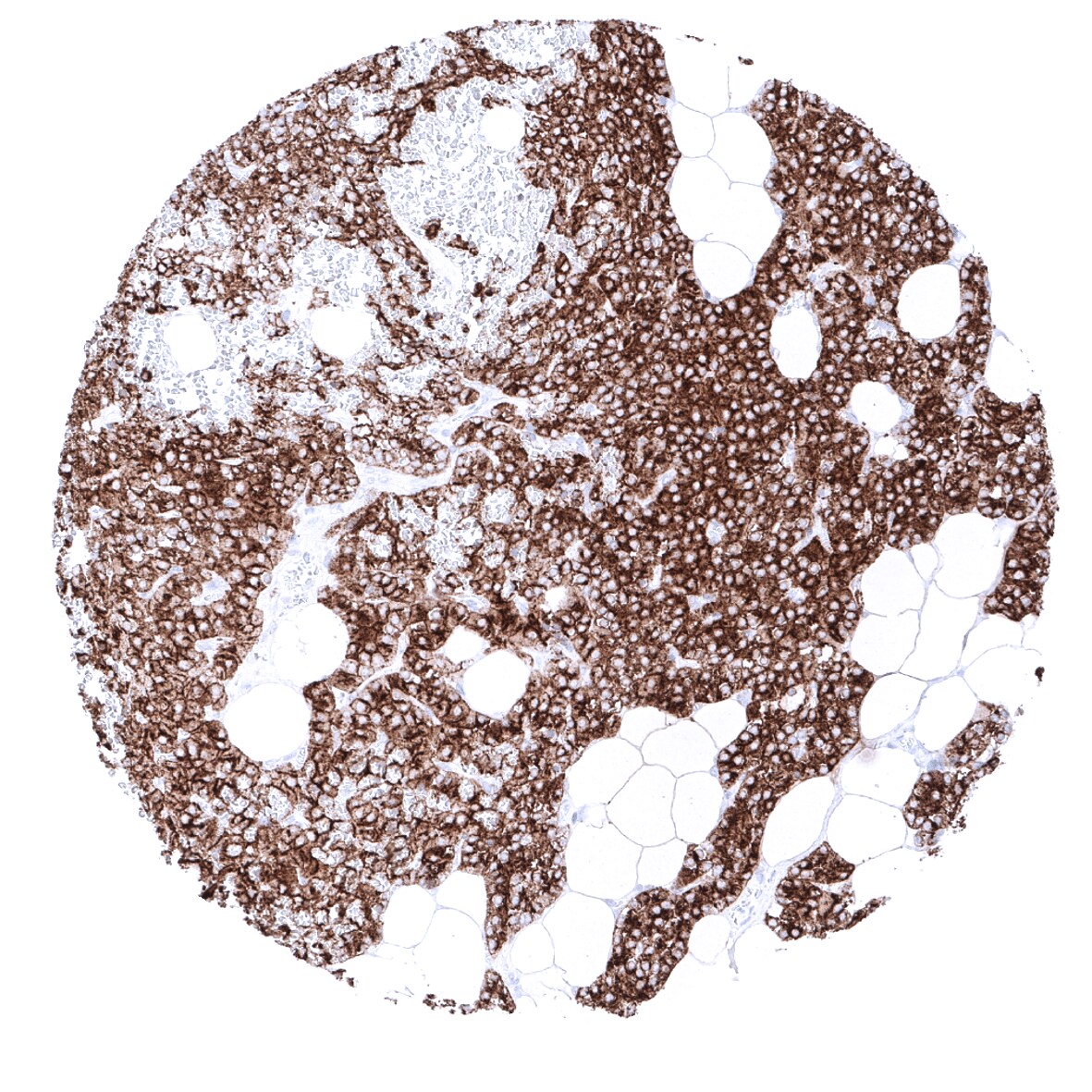 PTH Antibody (MSVA-525R)