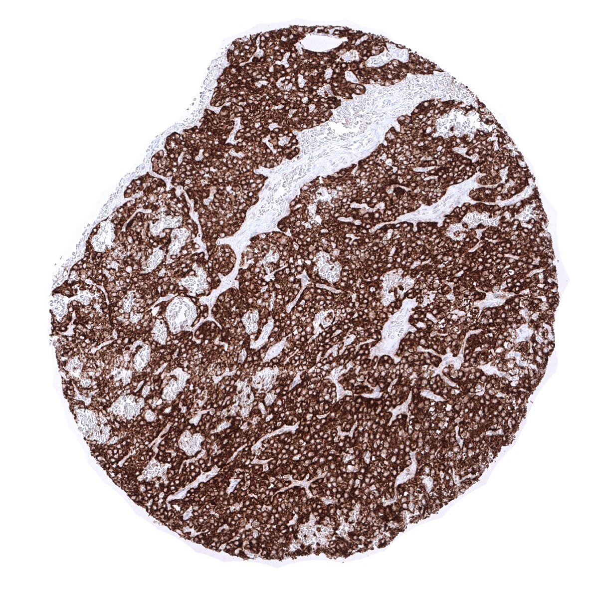 PTH Antibody (MSVA-525R)