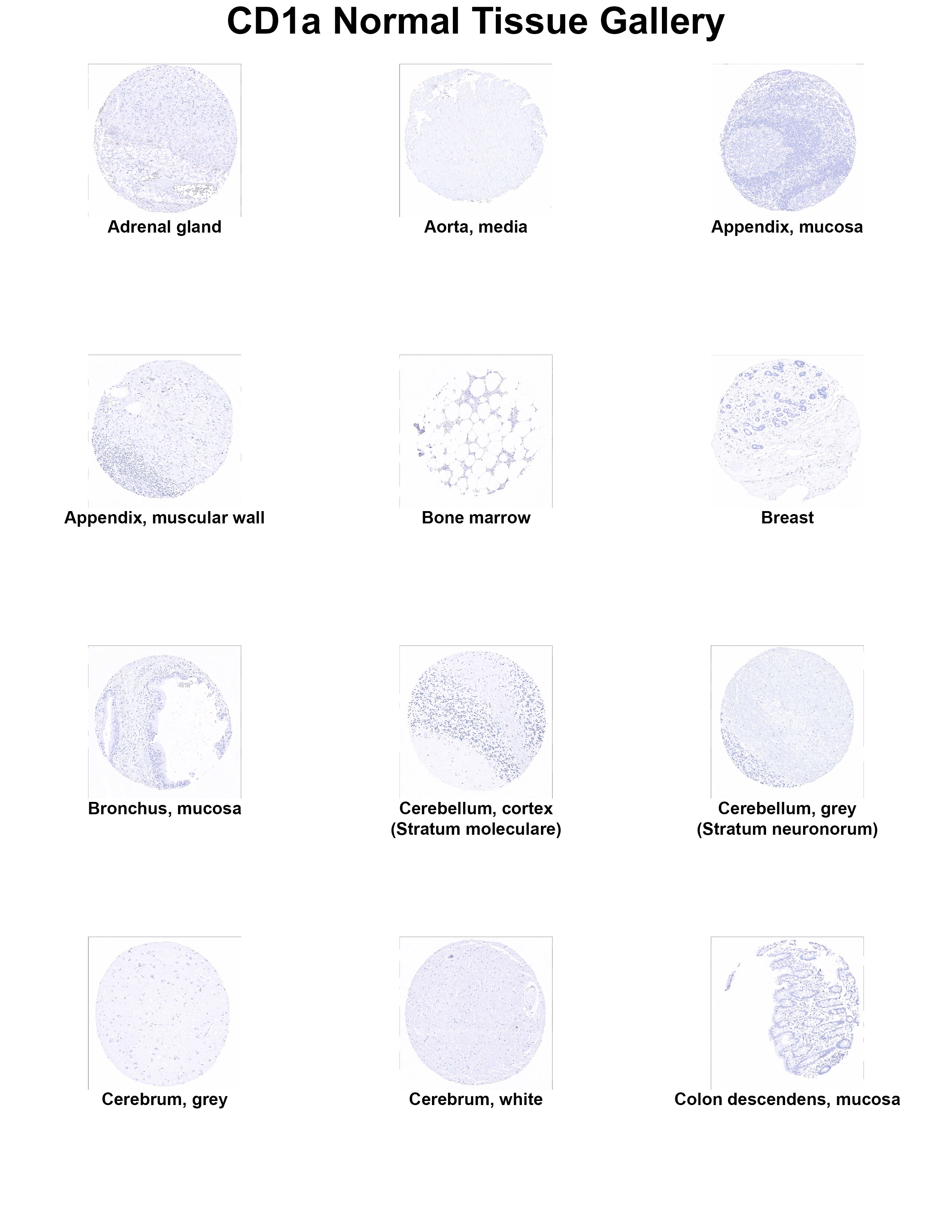 CD1a Antibody (MSVA-001M) CD1a Antibody (MSVA-001M) CD1a Normal Tissue Gallery