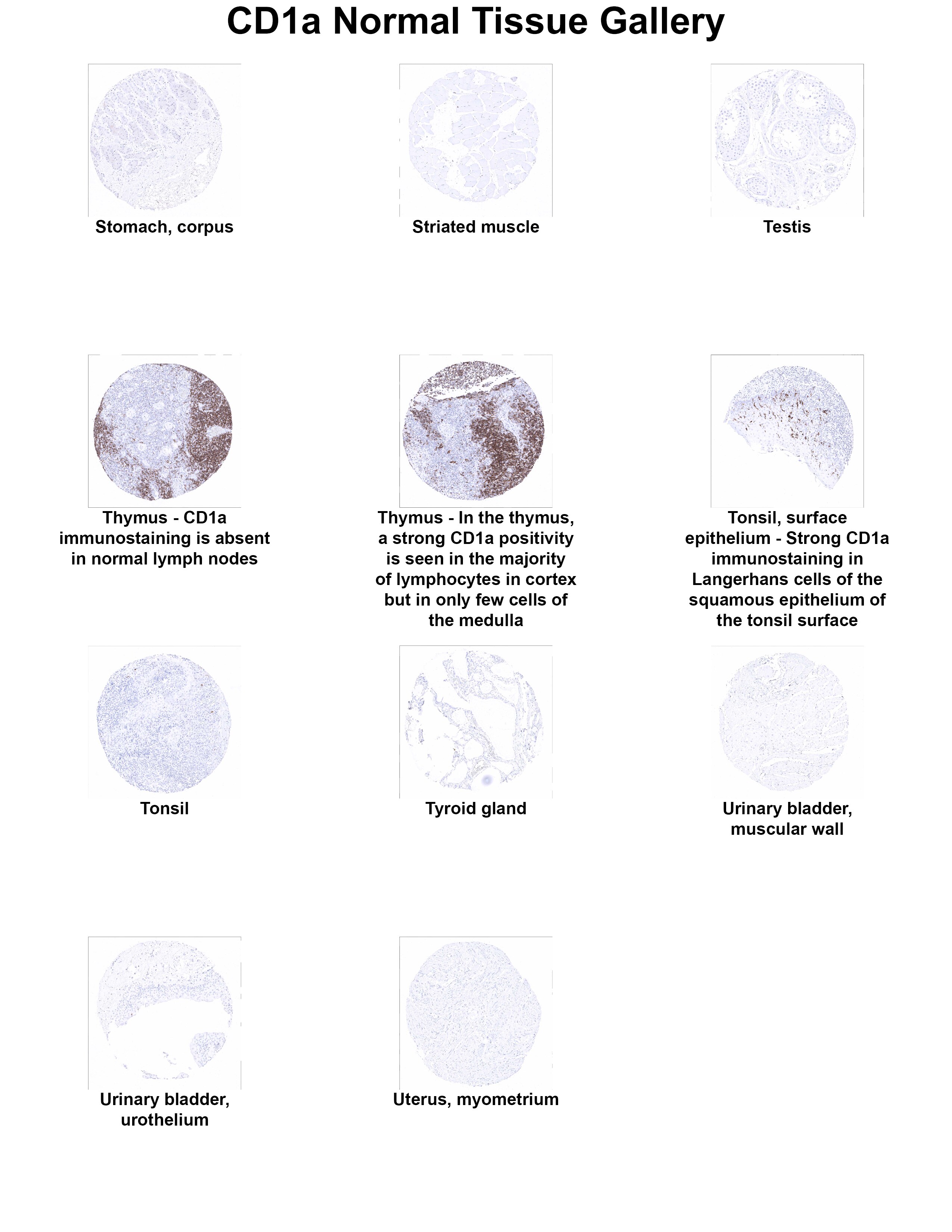 CD1a Antibody (MSVA-001M) CD1a Antibody (MSVA-001M) CD1a Normal Tissue Gallery