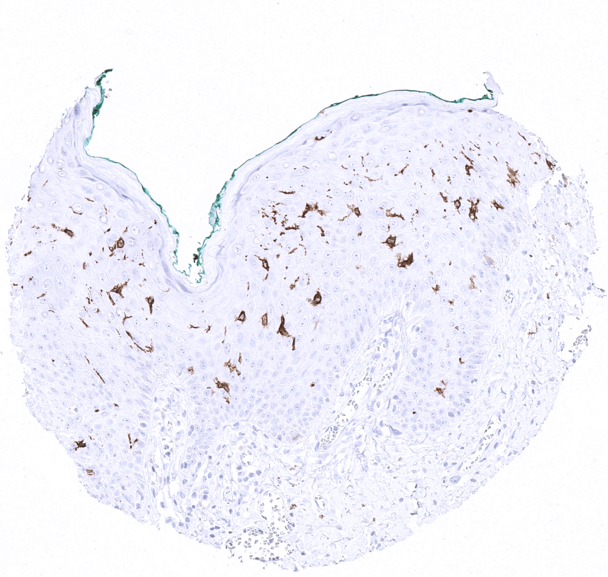 CD1a Antibody (MSVA-001M)
