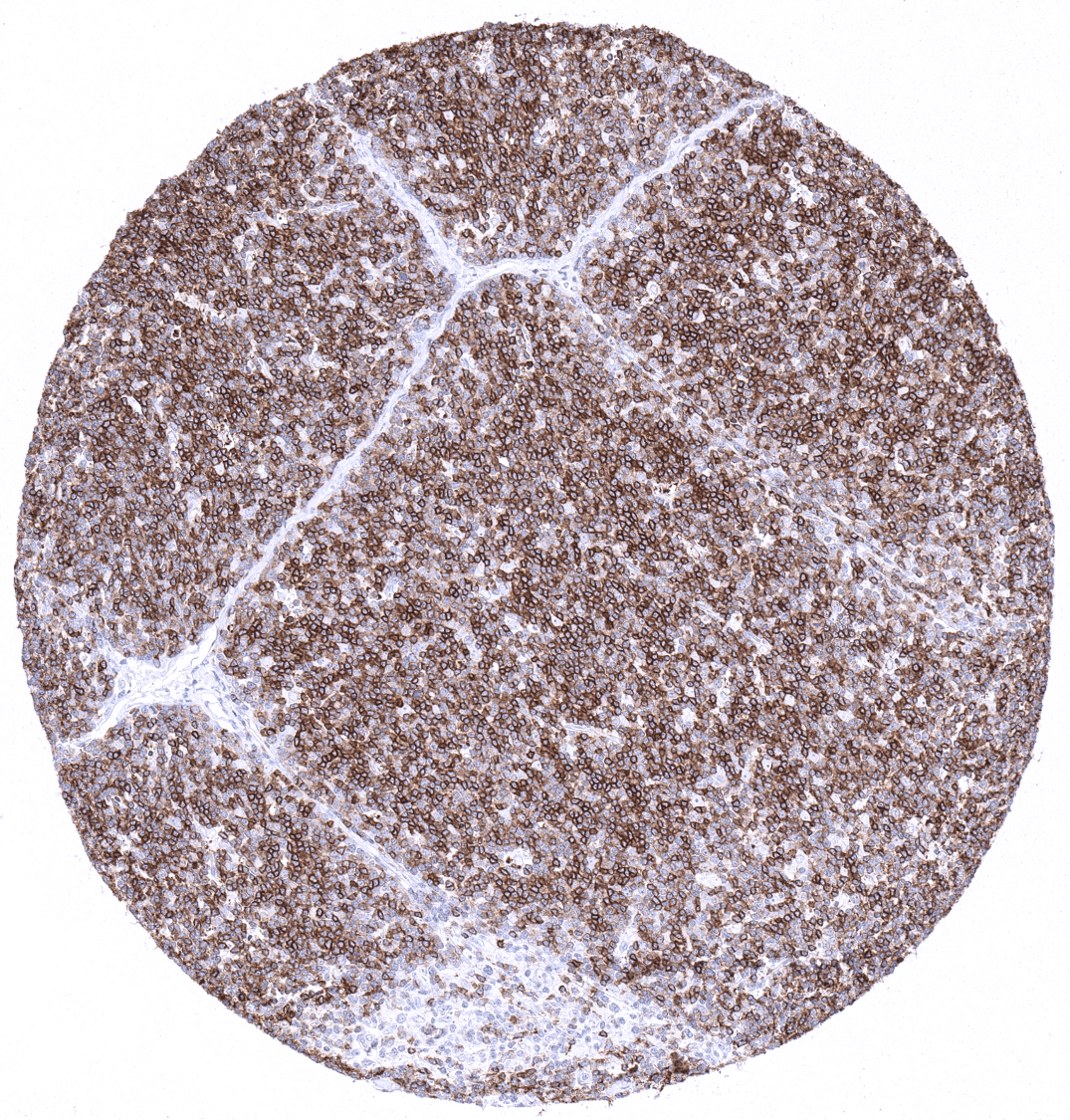 CD1a Antibody (MSVA-001M)