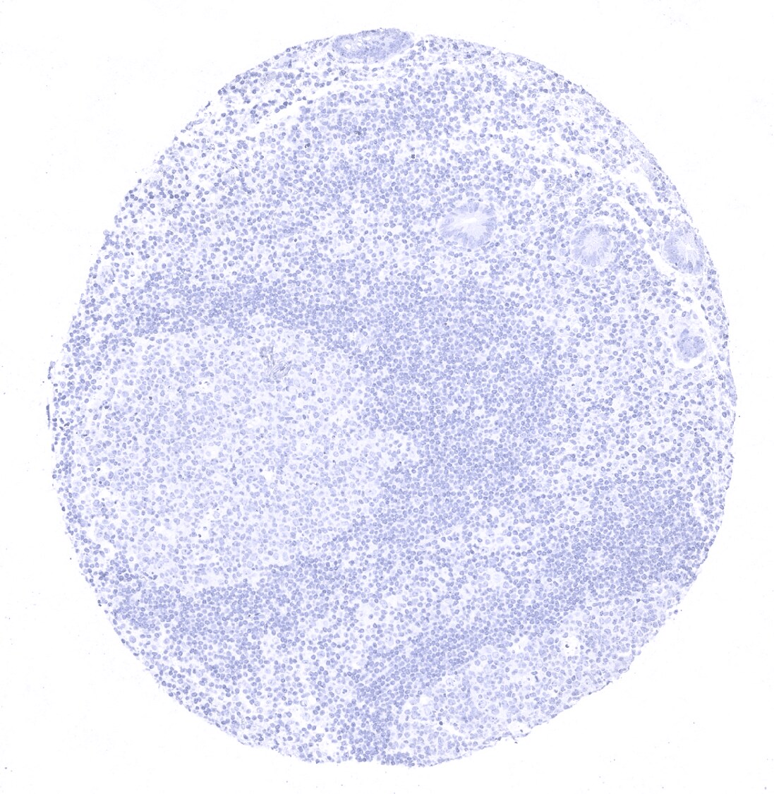 CD1a Antibody (MSVA-001M)