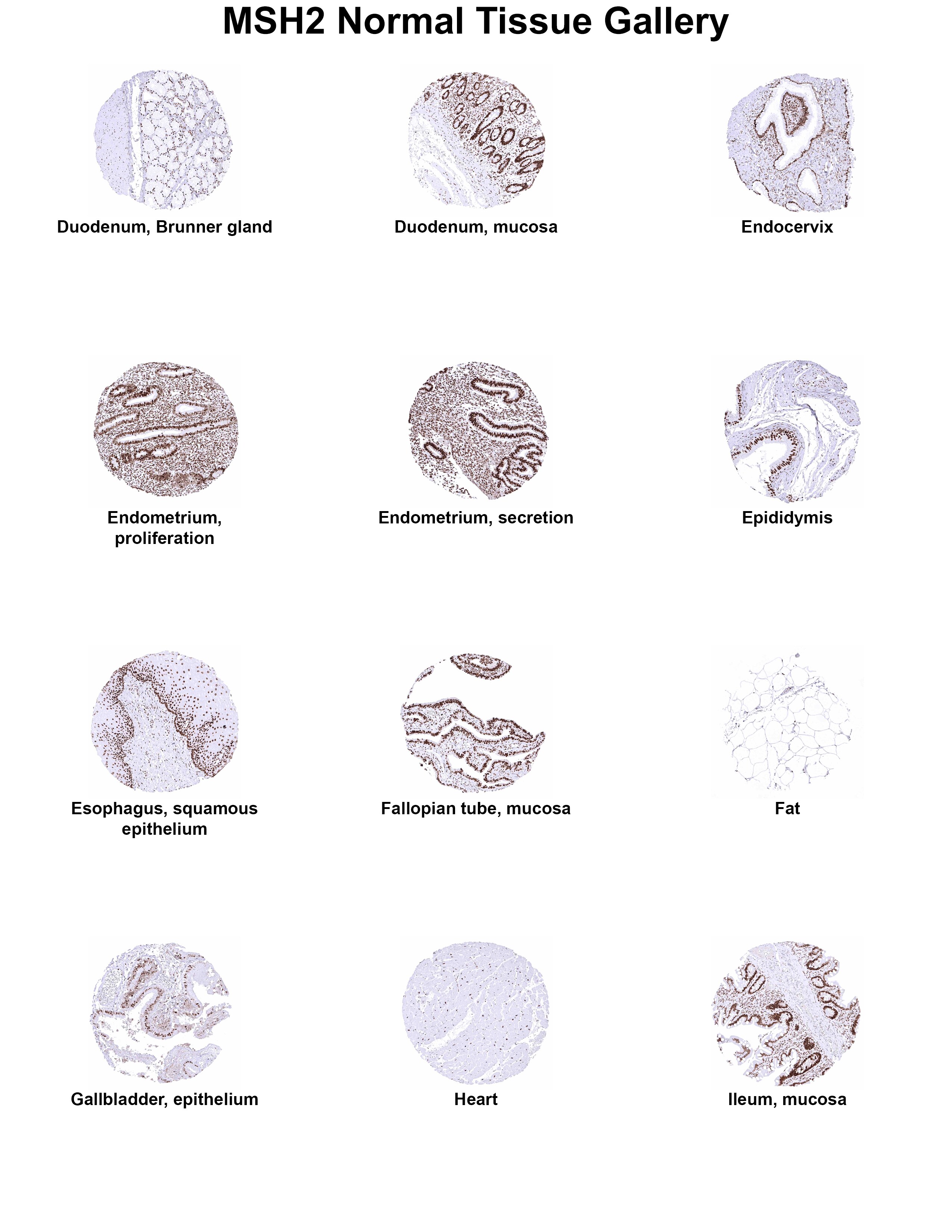 MSH2 Antibody (MSVA-902M) MSH2 Antibody (MSVA-902M) MSH2 Normal Tissue Gallery