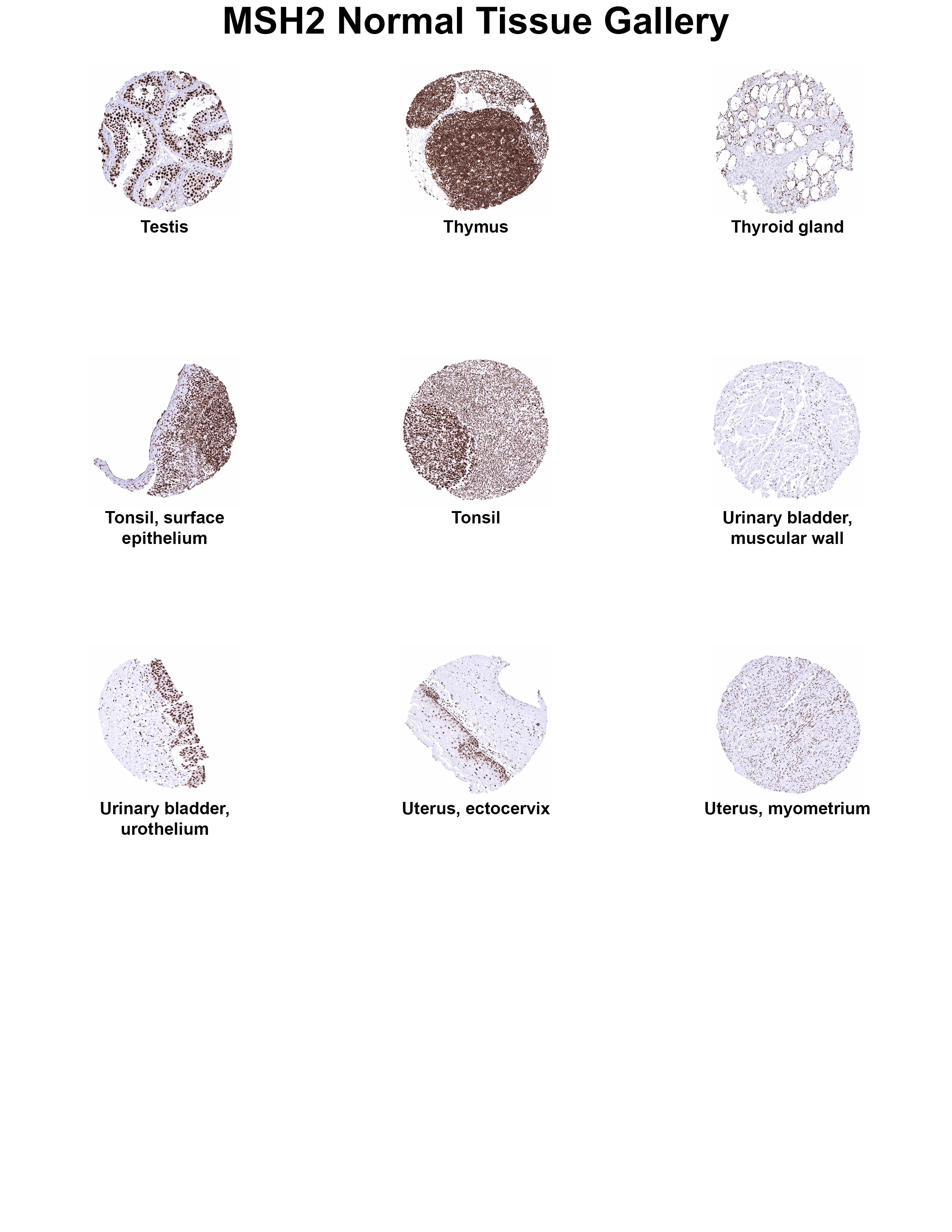 MSH2 Antibody (MSVA-902M) MSH2 Antibody (MSVA-902M) MSH2 Normal Tissue Gallery