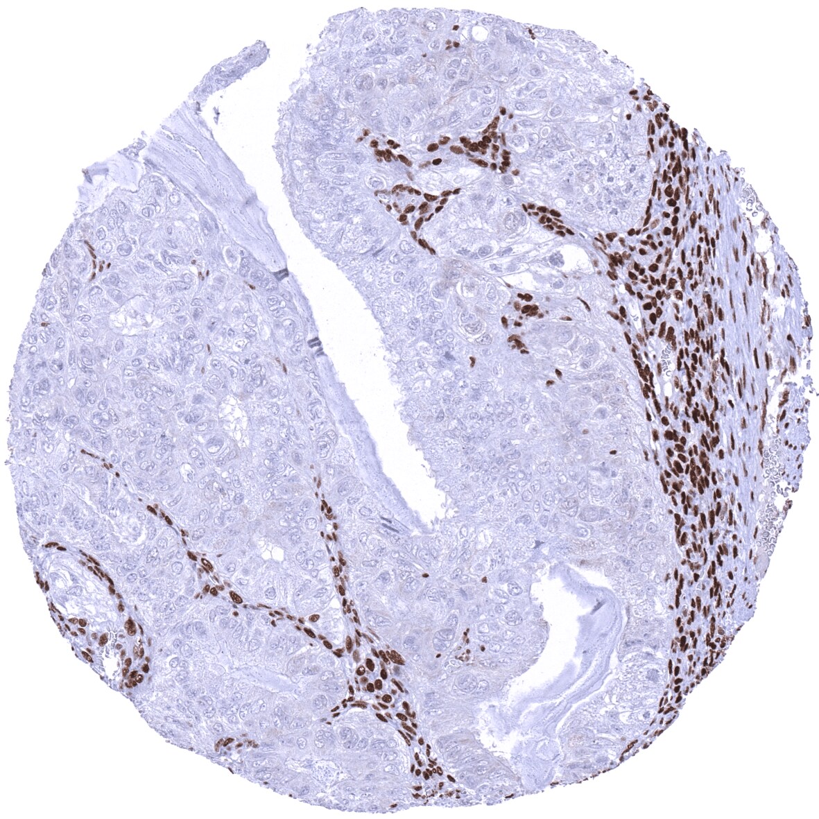MSH2 Antibody (MSVA-902M)