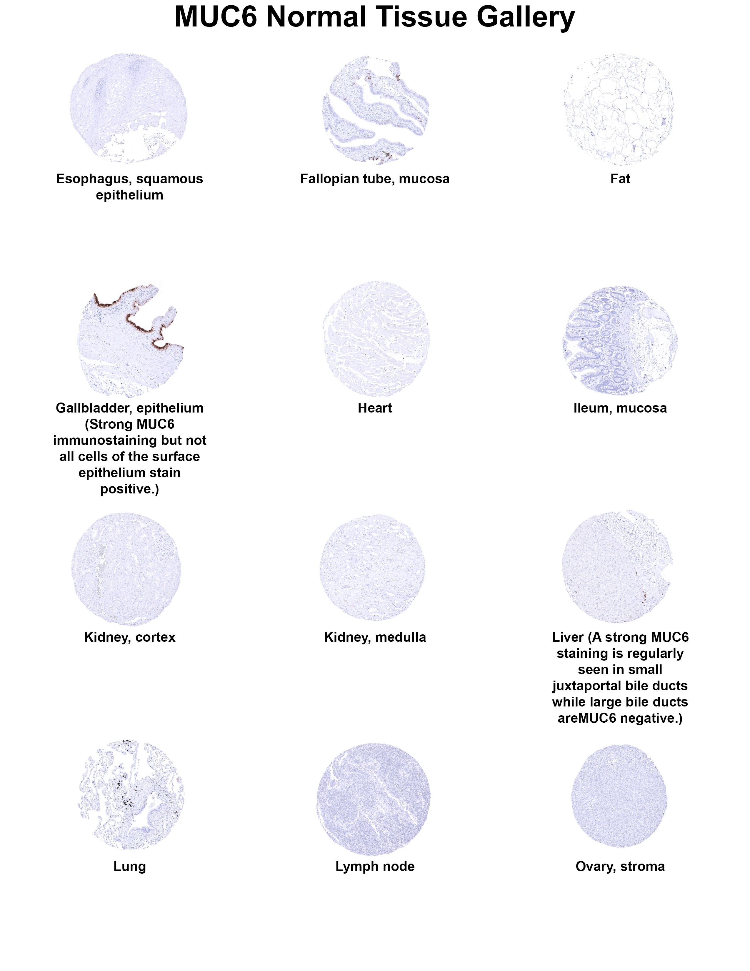 MUC6 Antibody (MSVA-806R) MUC6 Antibody (MSVA-806R) MUC6 Normal Tissue Gallery