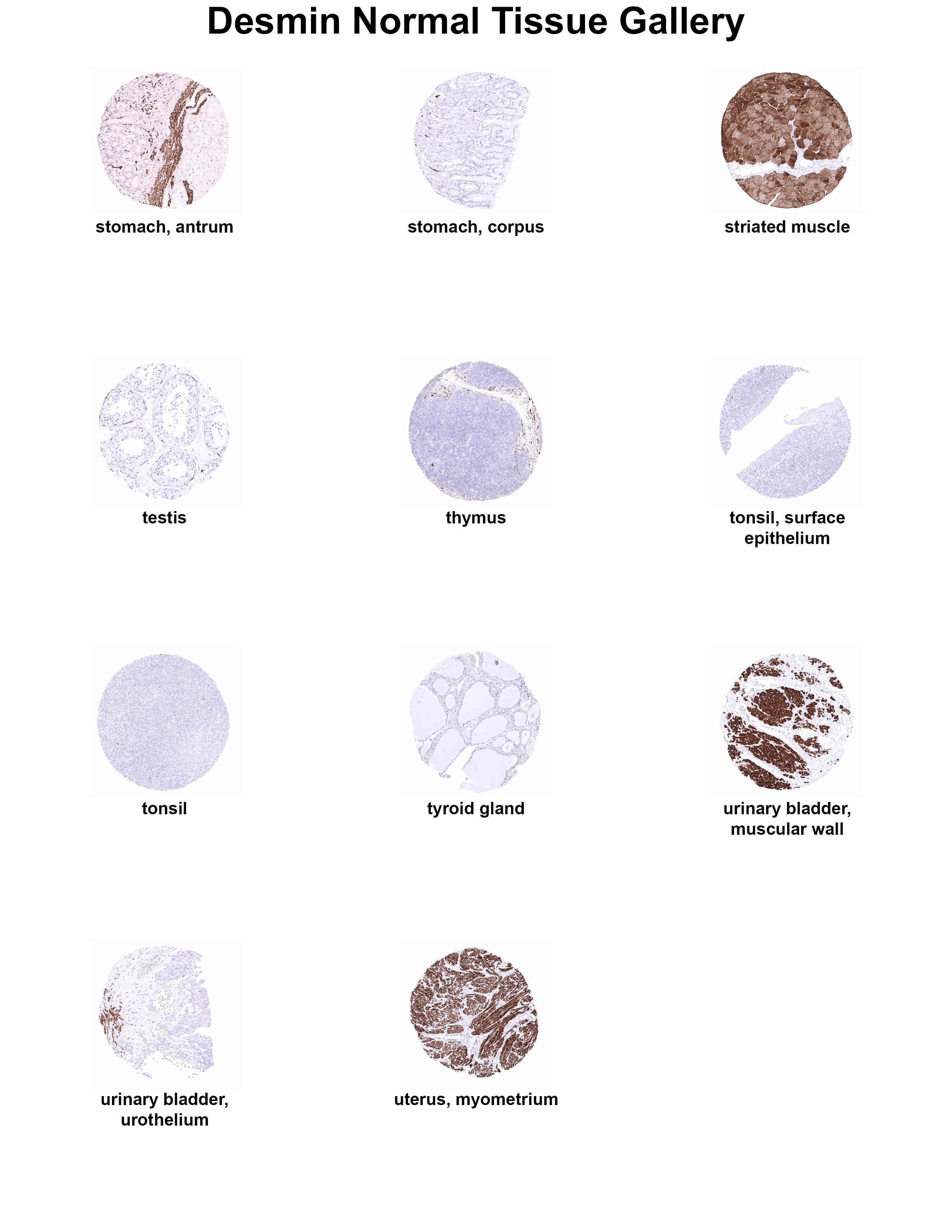 Desmin Antibody (MSVA-651M) Desmin Antibody (MSVA-651M) Desmin Normal Tissue Gallery