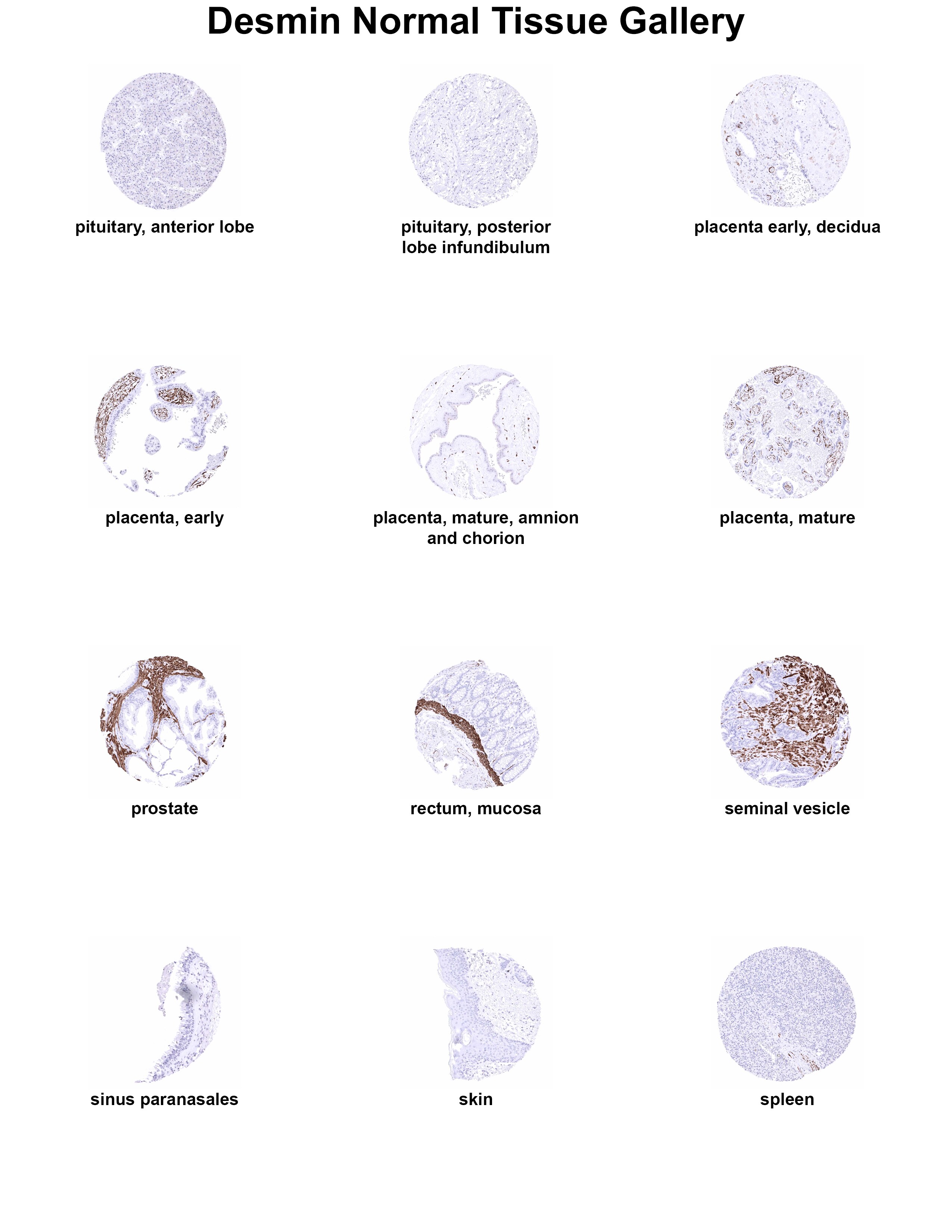 Desmin Antibody (MSVA-651M) Desmin Antibody (MSVA-651M) Desmin Normal Tissue Gallery