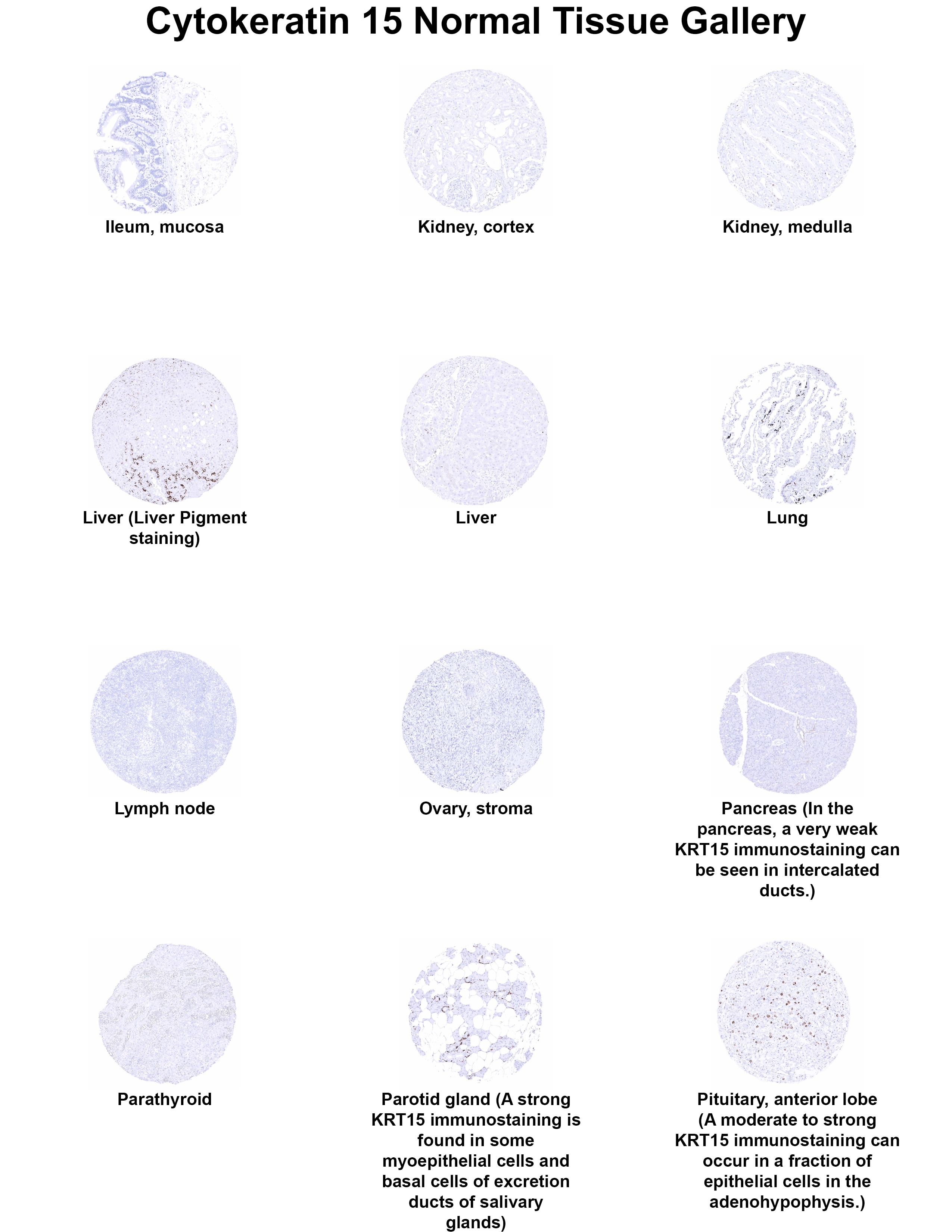 Cytokeratin 15 Antibody (MSVA-615M) Cytokeratin 15 Antibody (MSVA-615M) Cytokeratin 15 Normal Tissue Gallery