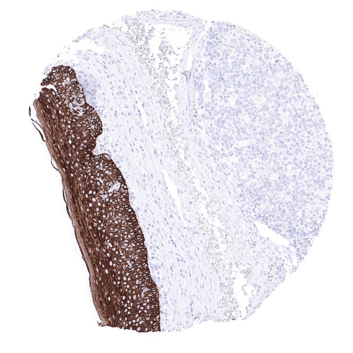 Cytokeratin 15 Antibody (MSVA-615M)