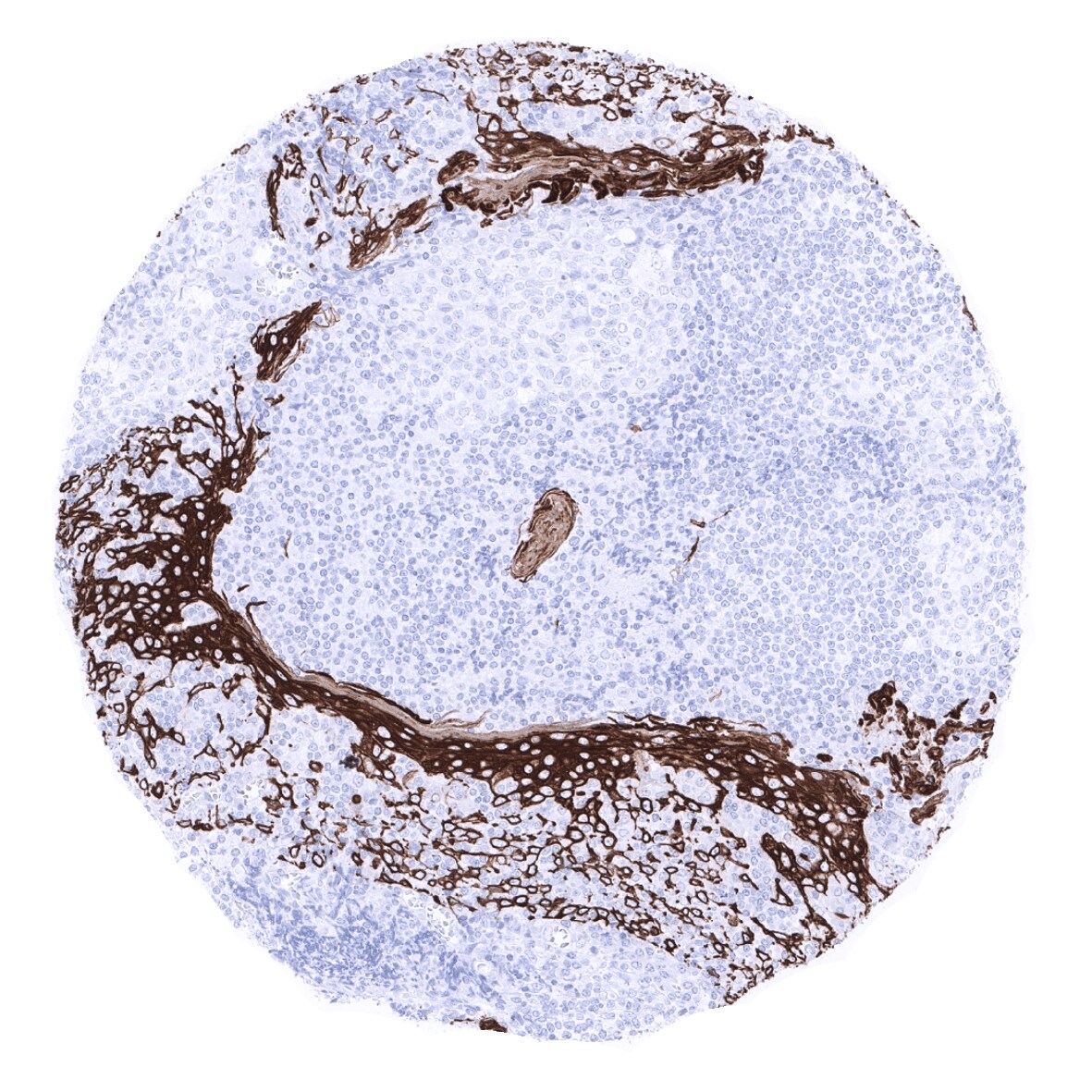 Cytokeratin 15 Antibody (MSVA-615M)
