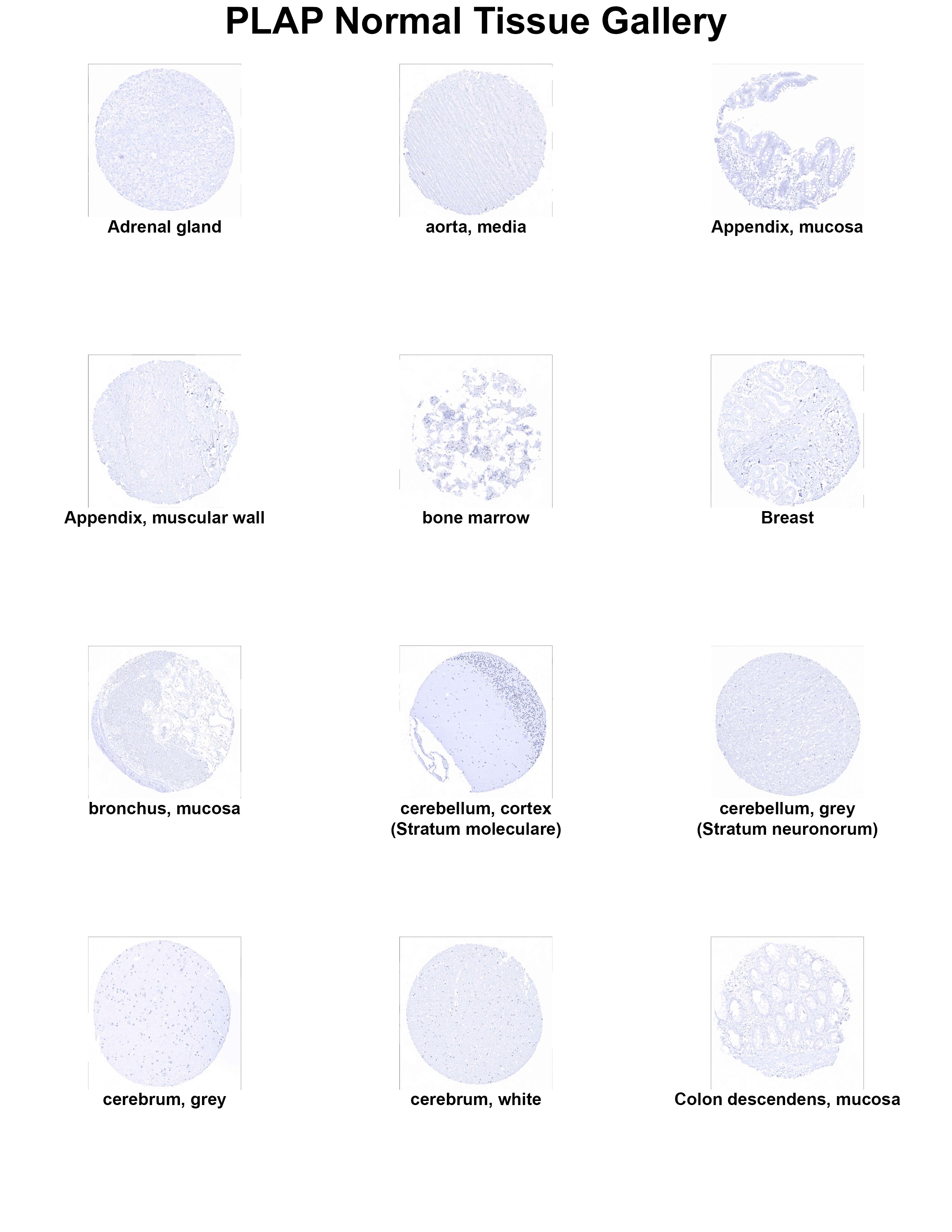 PLAP Antibody (MSVA-350R) PLAP Antibody (MSVA-350R) PLAP Normal Tissue Gallery