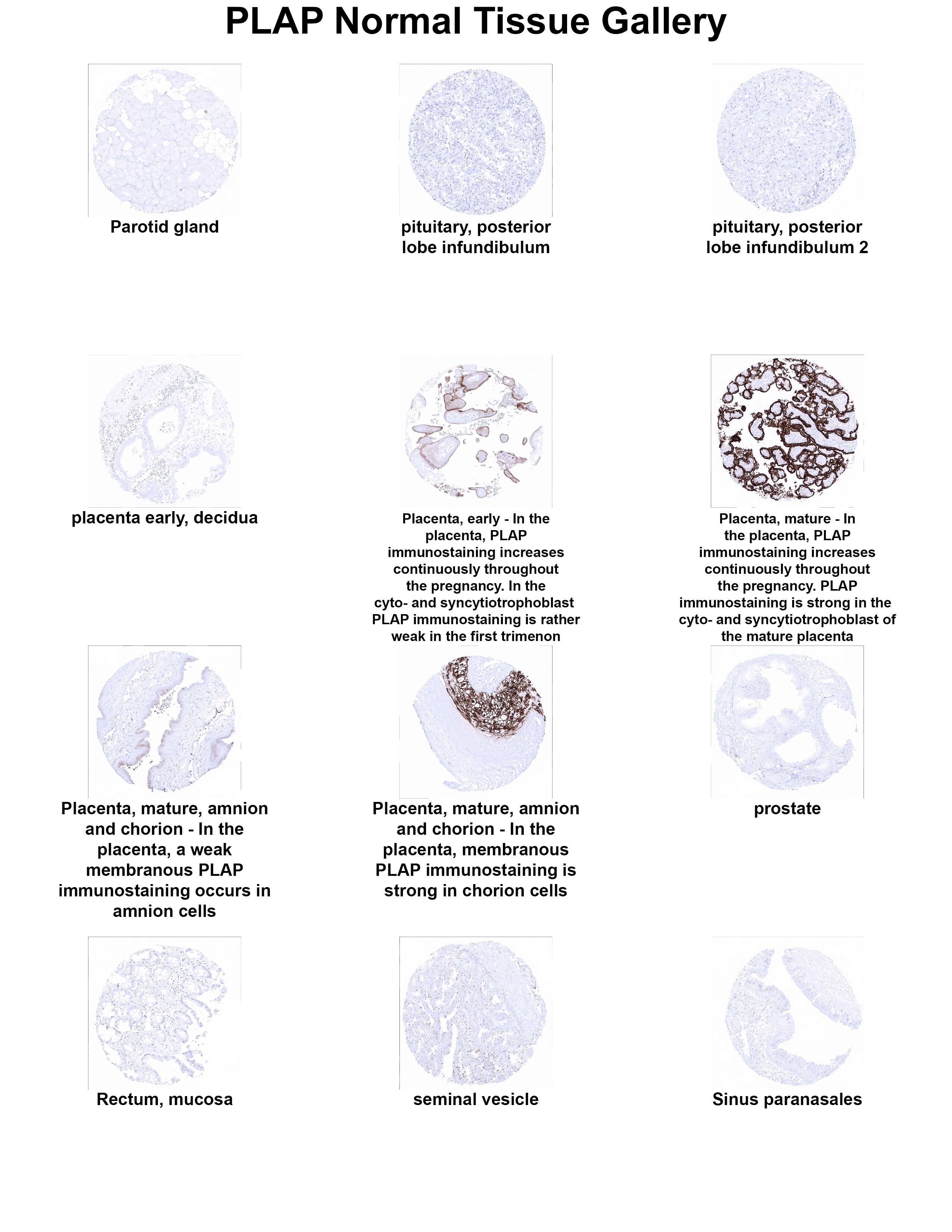 PLAP Antibody (MSVA-350R) PLAP Antibody (MSVA-350R) PLAP Normal Tissue Gallery