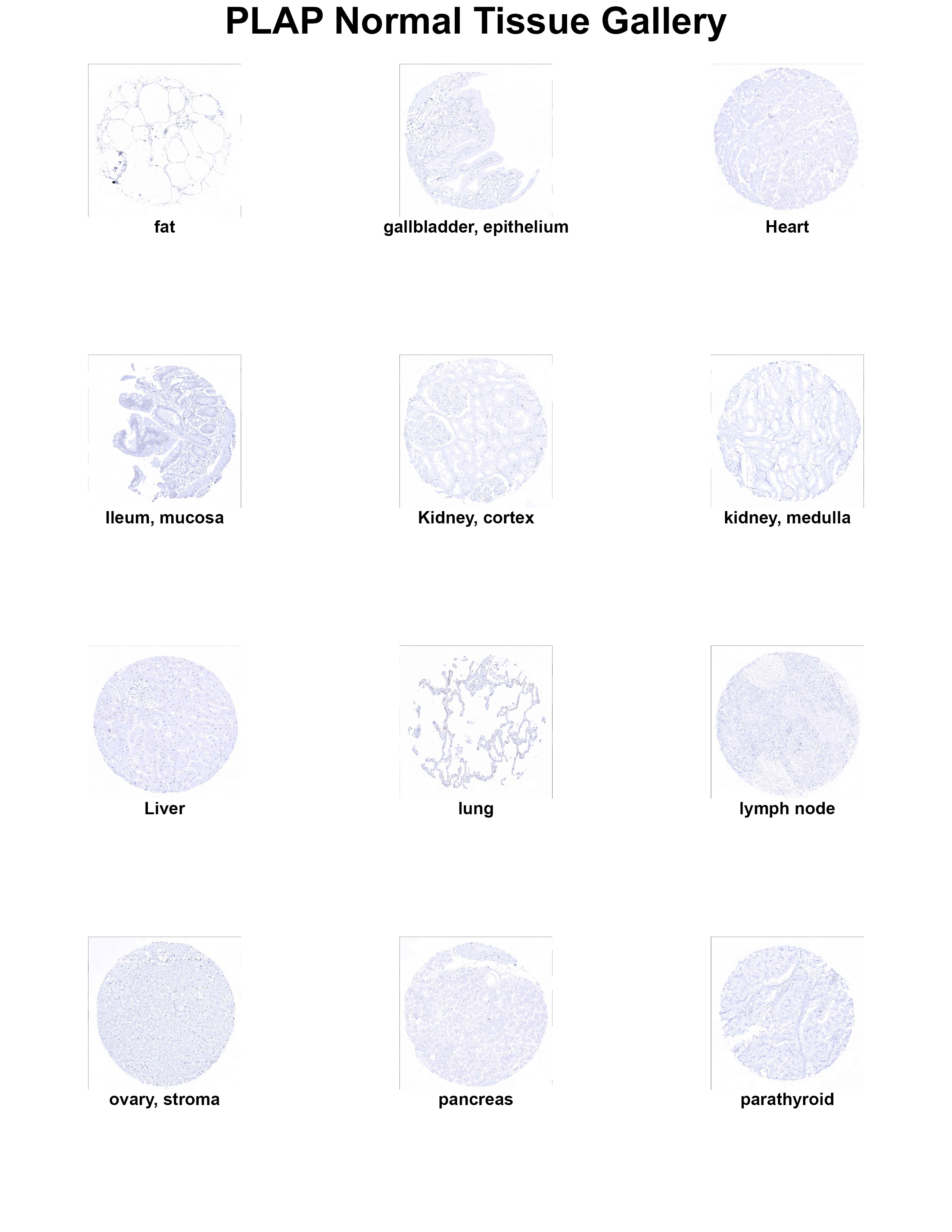 PLAP Antibody (MSVA-350R) PLAP Antibody (MSVA-350R) PLAP Normal Tissue Gallery