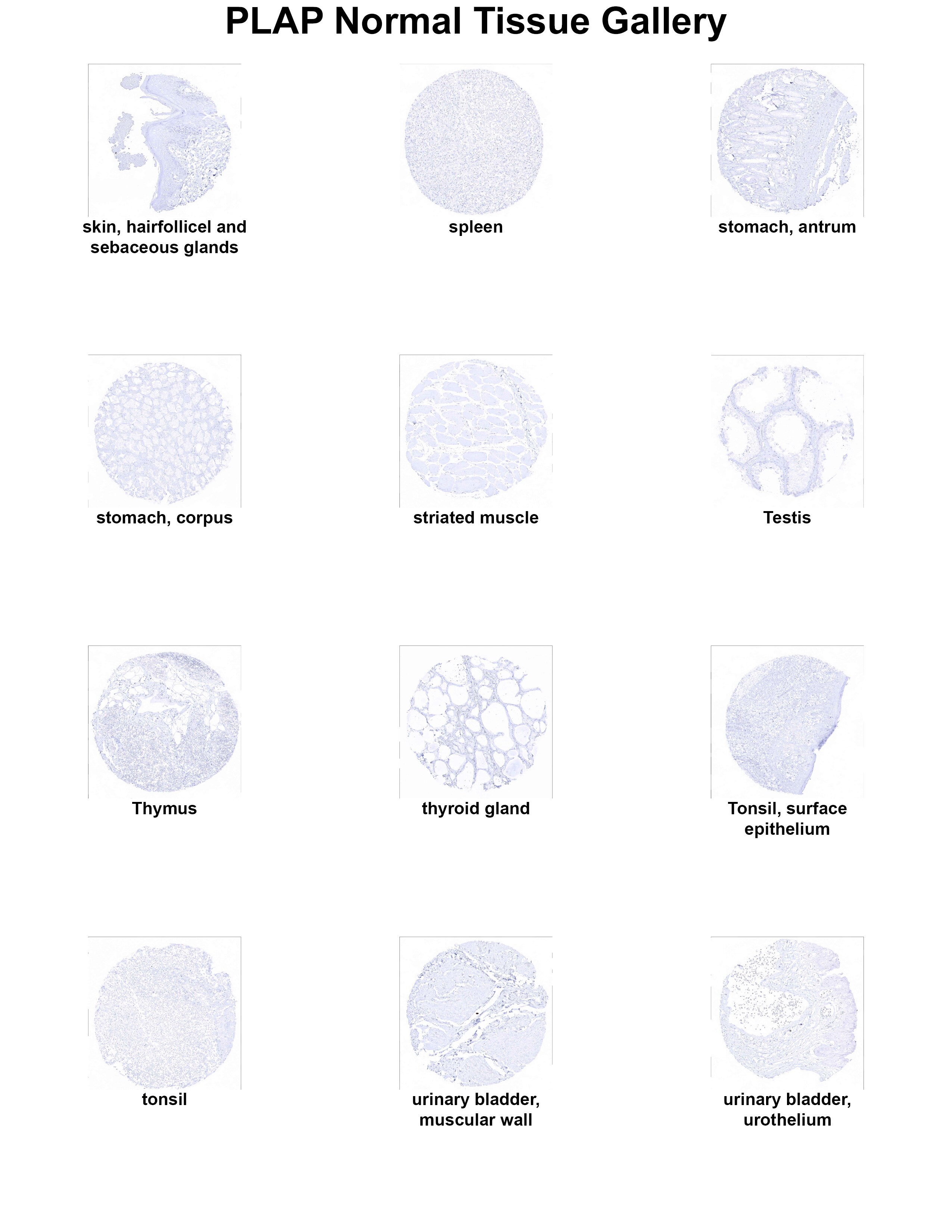 PLAP Antibody (MSVA-350R) PLAP Antibody (MSVA-350R) PLAP Normal Tissue Gallery