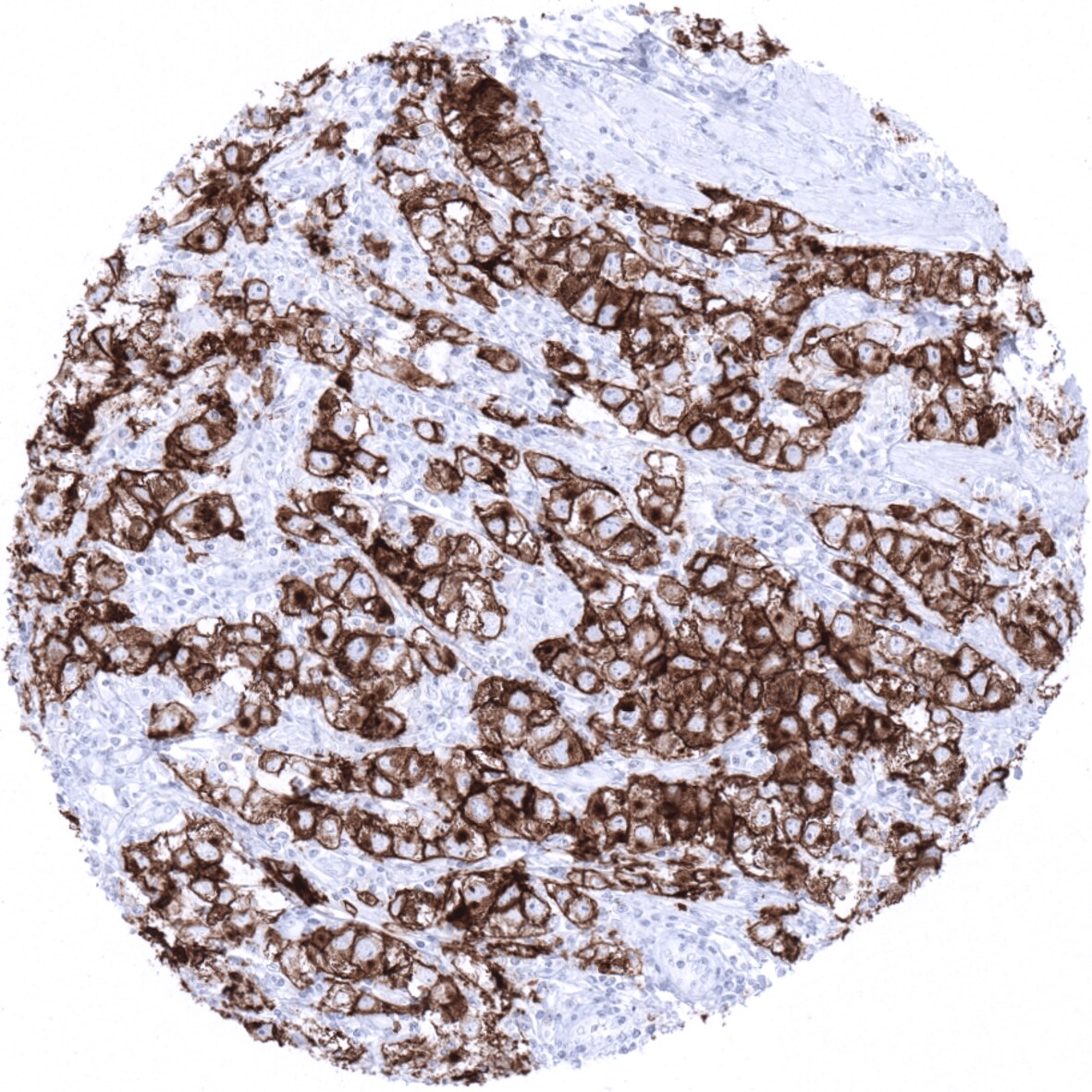 PLAP Antibody (MSVA-350R)