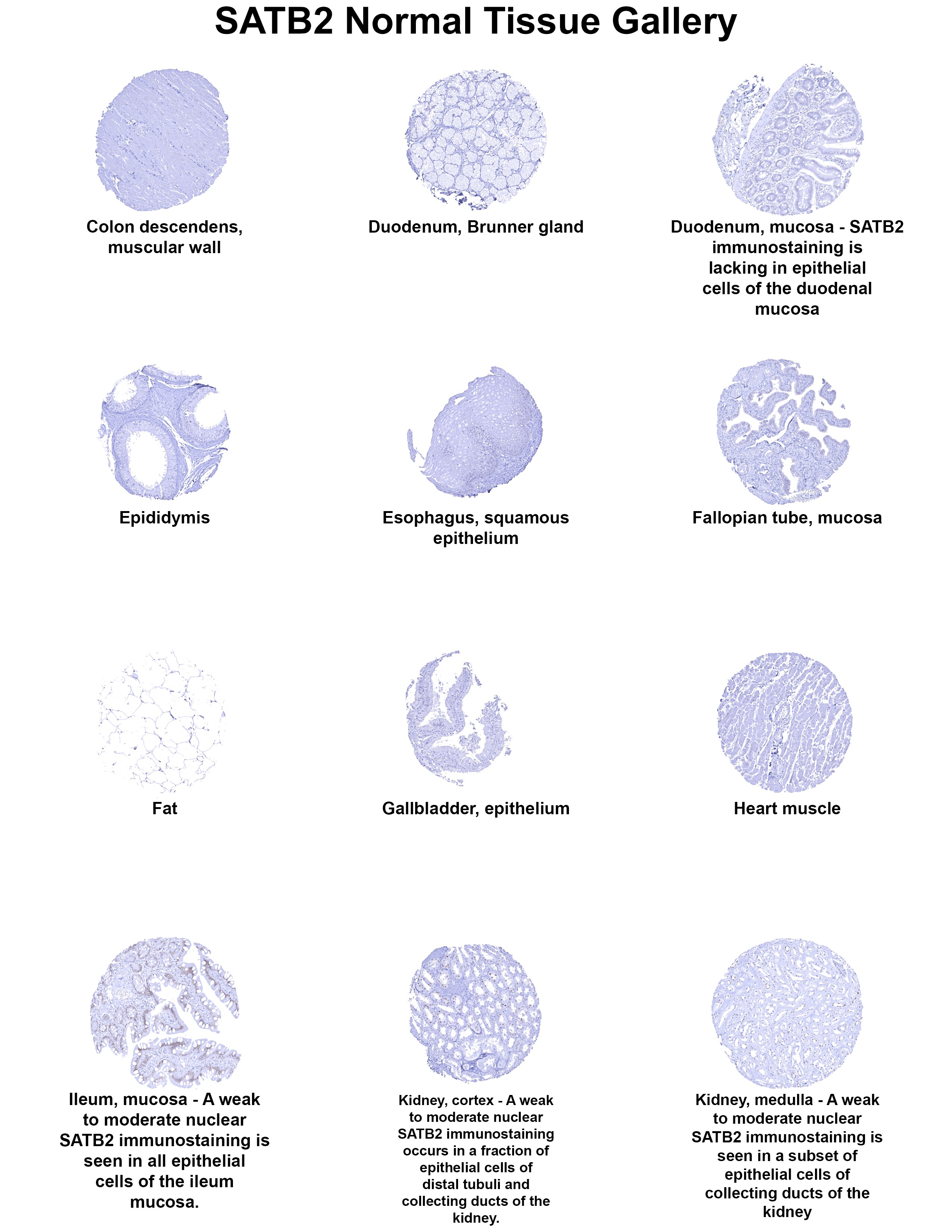 SATB2 Antibody (MSVA-702R) SATB2 Antibody (MSVA-702R) SATB2 Normal Tissue Gallery
