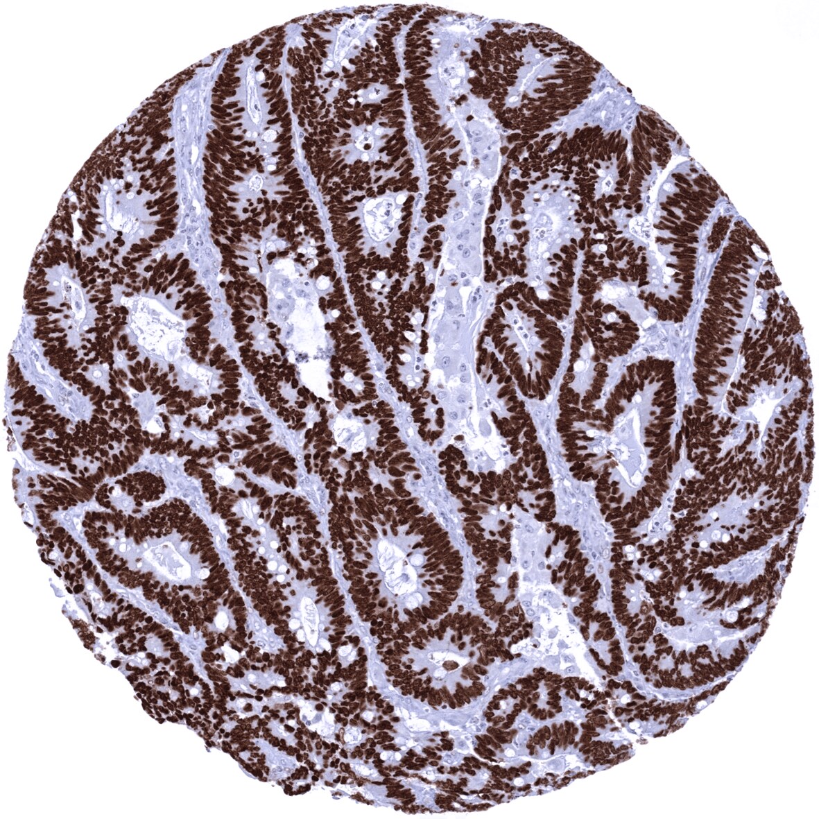 SATB2 Antibody (MSVA-702R)