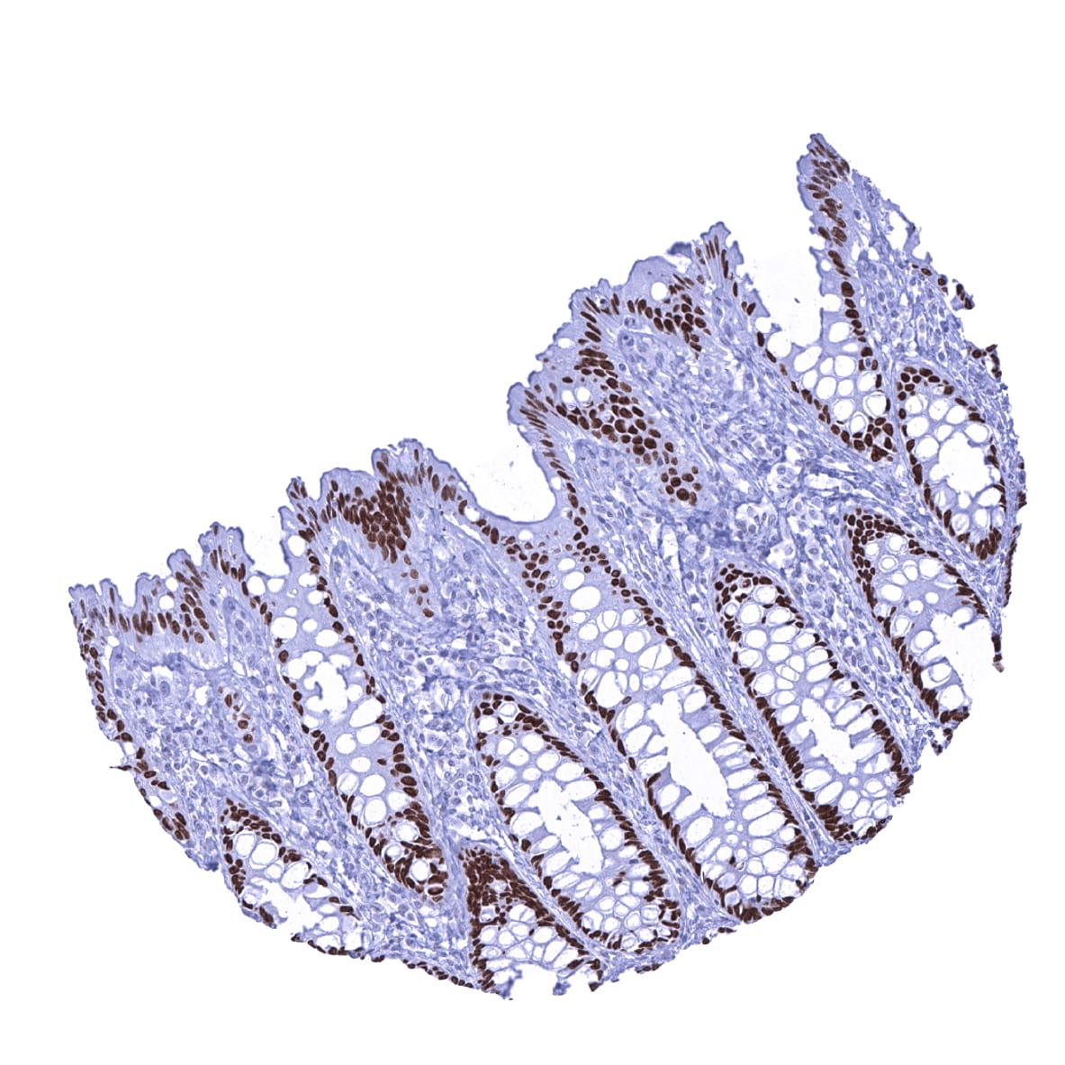 SATB2 Antibody (MSVA-702R)