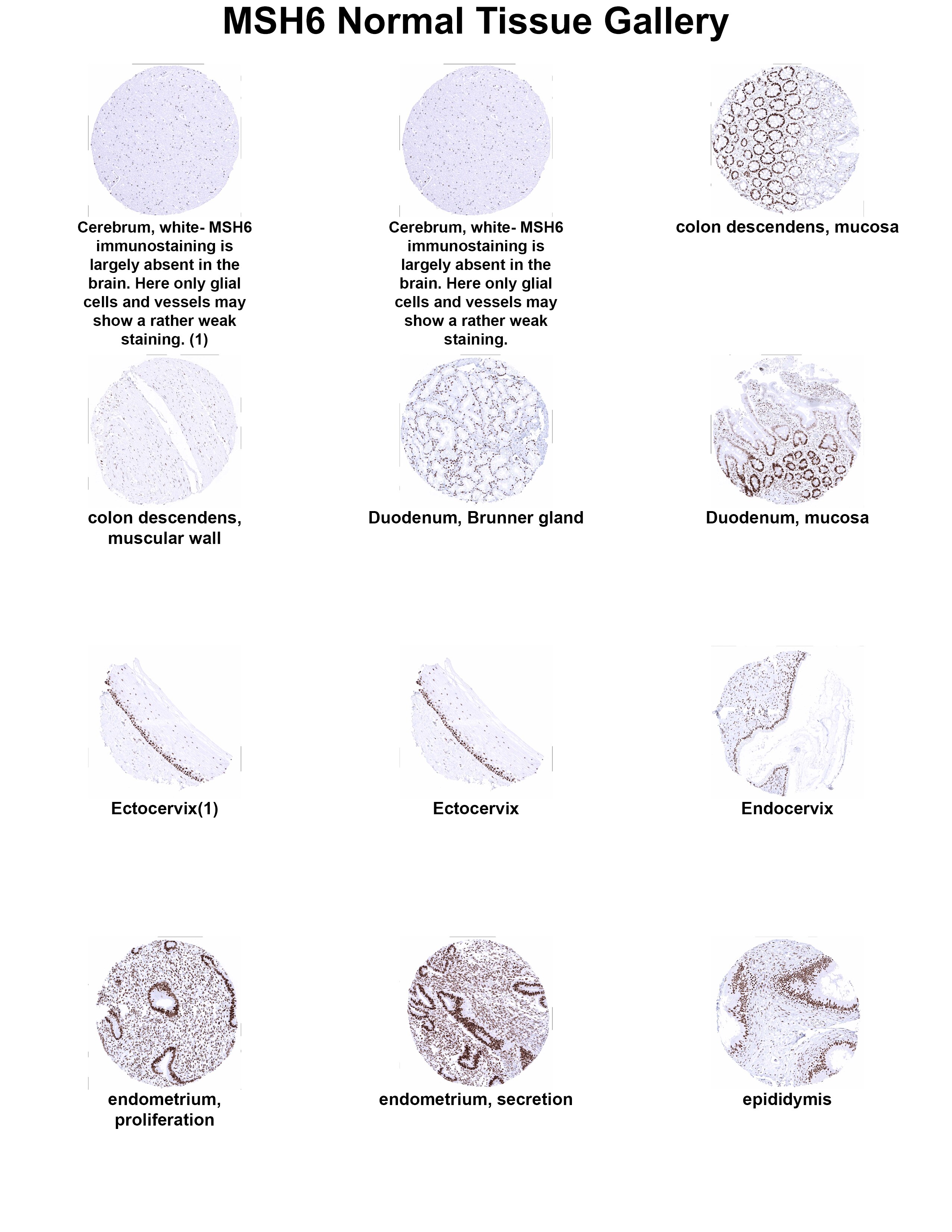 MSH6 Antibody (MSVA-906R) MSH6 Antibody (MSVA-906R) MSH6 Normal Tissue Gallery