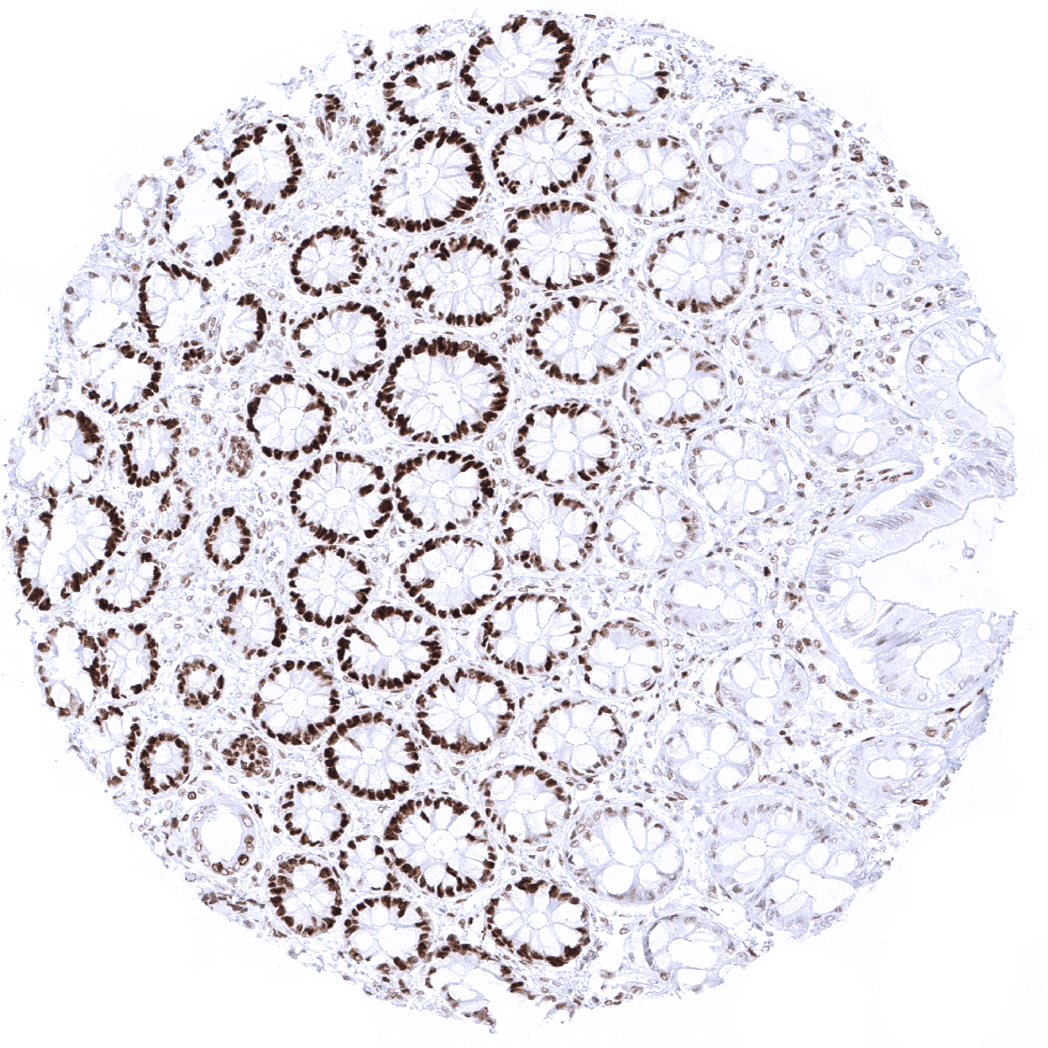 MSH6 Antibody (MSVA-906R)