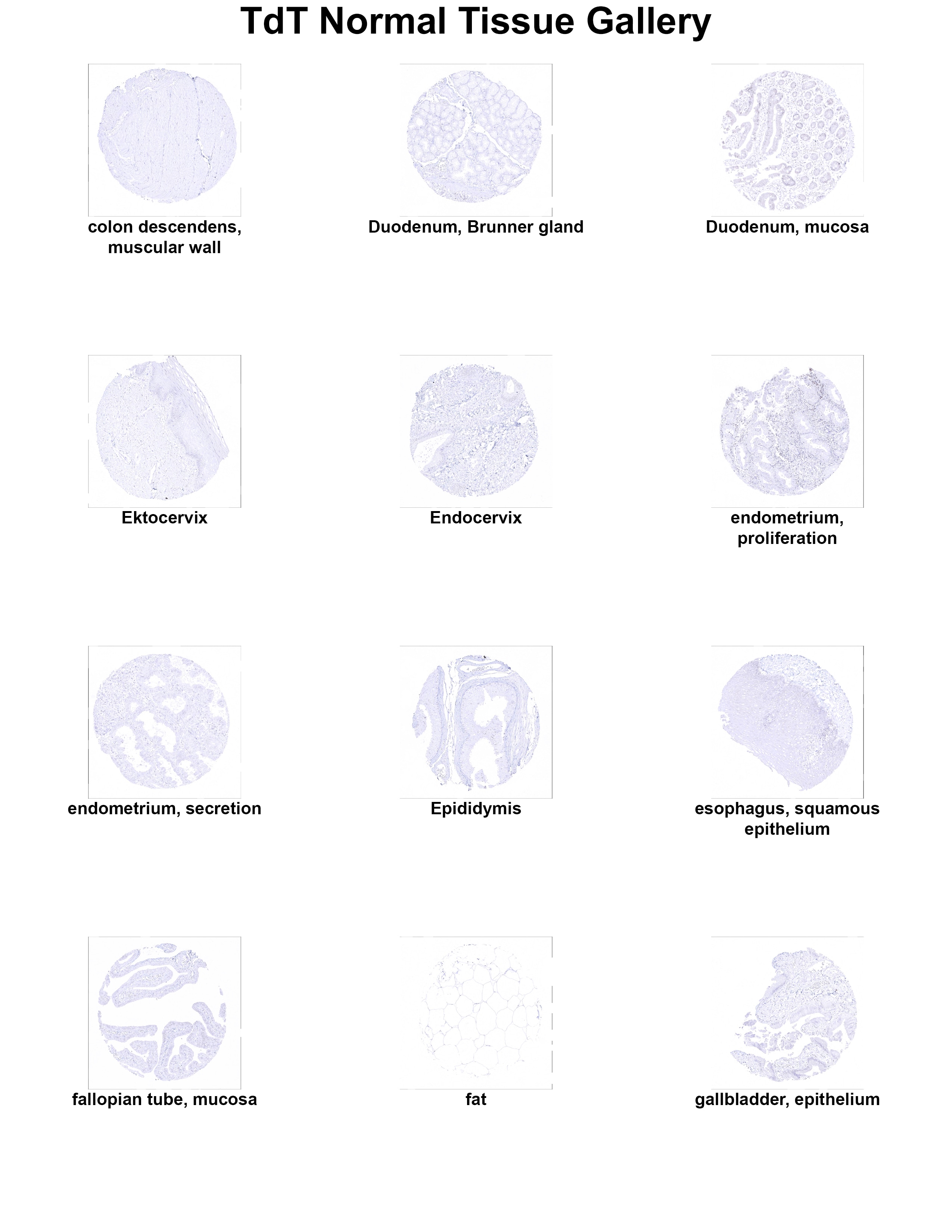 TdT Antibody (MSVA-453R) TdT Antibody (MSVA-453R) TdT Normal Tissue Gallery