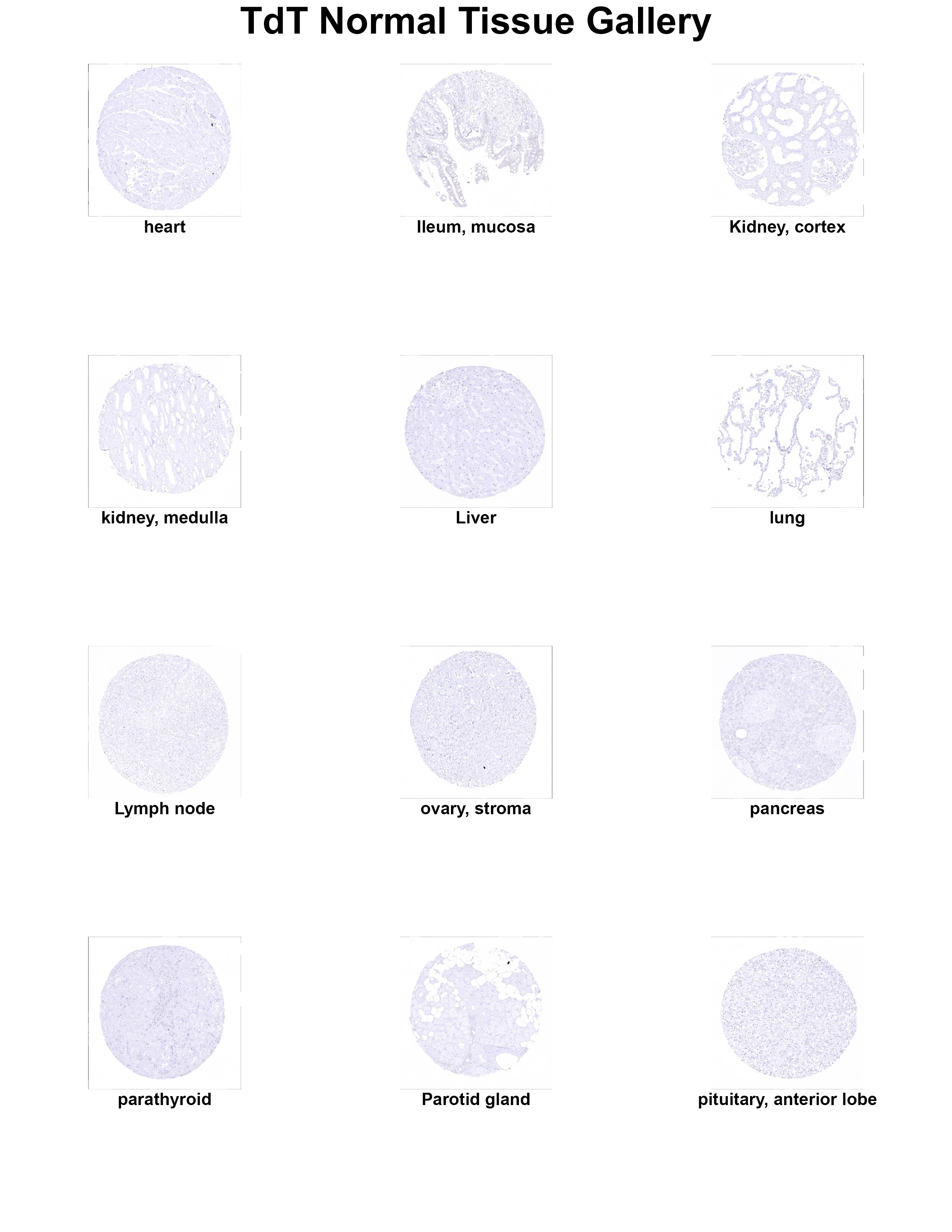 TdT Antibody (MSVA-453R) TdT Antibody (MSVA-453R) TdT Normal Tissue Gallery